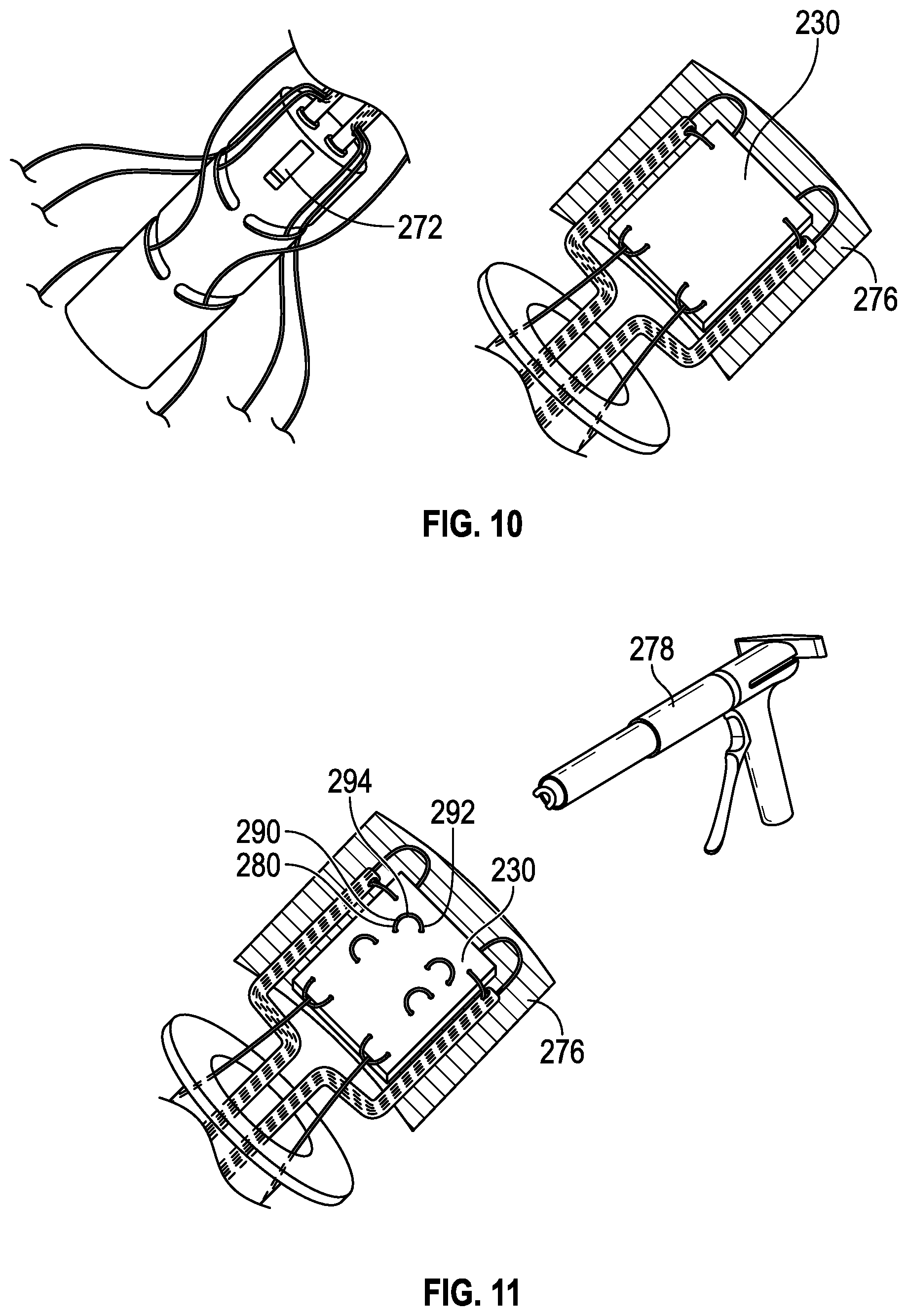 Patent US11771416 Figure 6 – Surgical tools and associated graft augmentation techniques