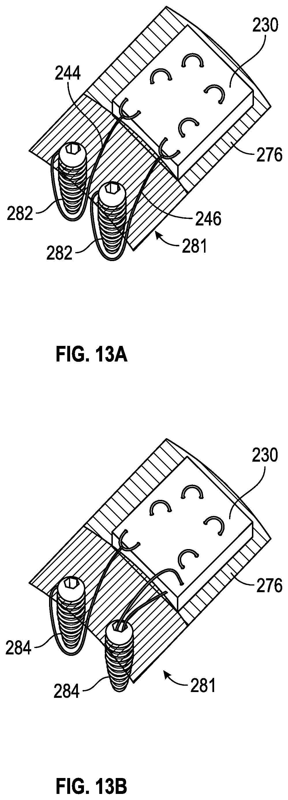Patent US11771416 Figure 8 – Surgical tools and associated graft augmentation techniques