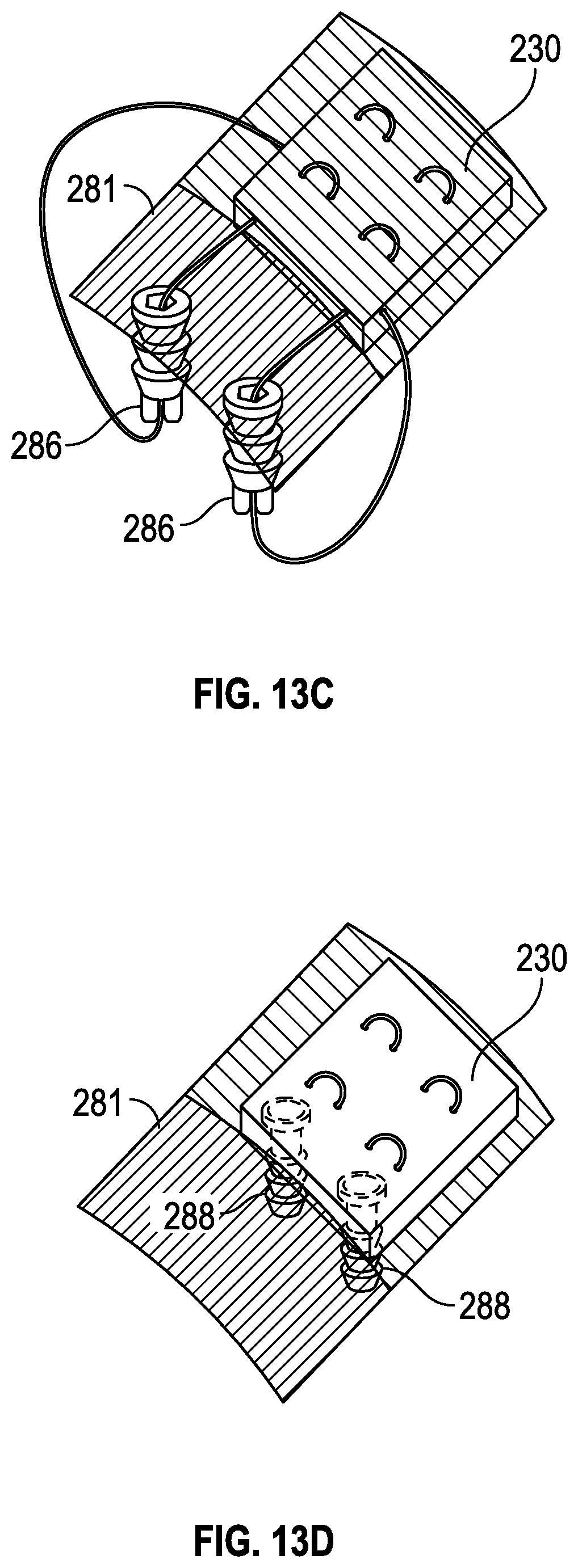 Patent US11771416 Figure 9 – Surgical tools and associated graft augmentation techniques