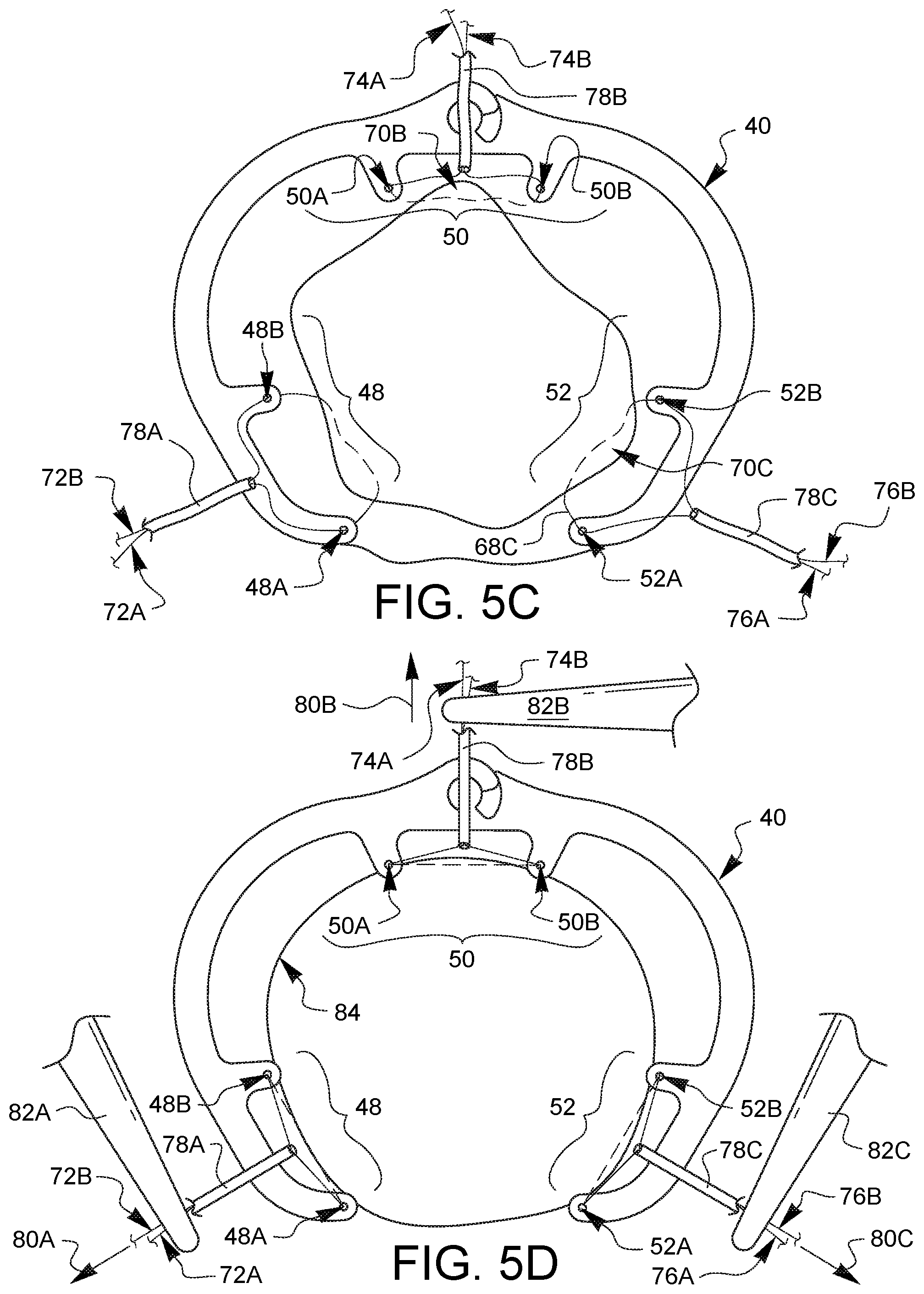 Patent US11771417 Figure 4 – Device for cardiac surgery and methods thereof