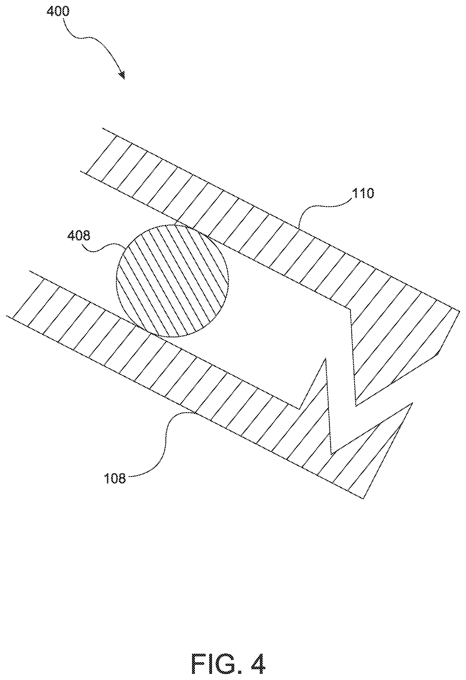 Patent US11771418 Figure 4 – Combination forceps