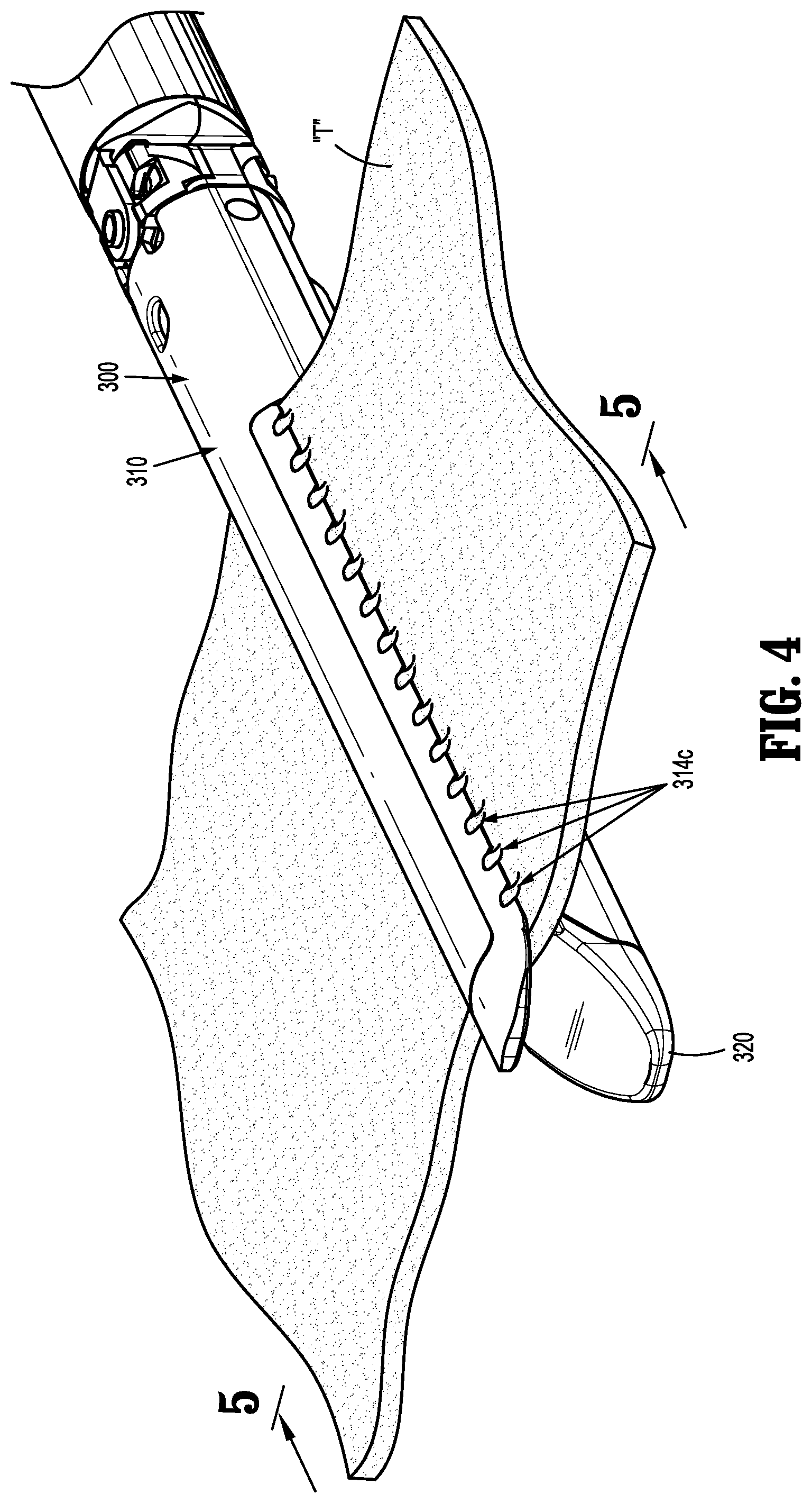 Patent US11771429 Figure 6 – Surgical stapling apparatus with tissue pockets