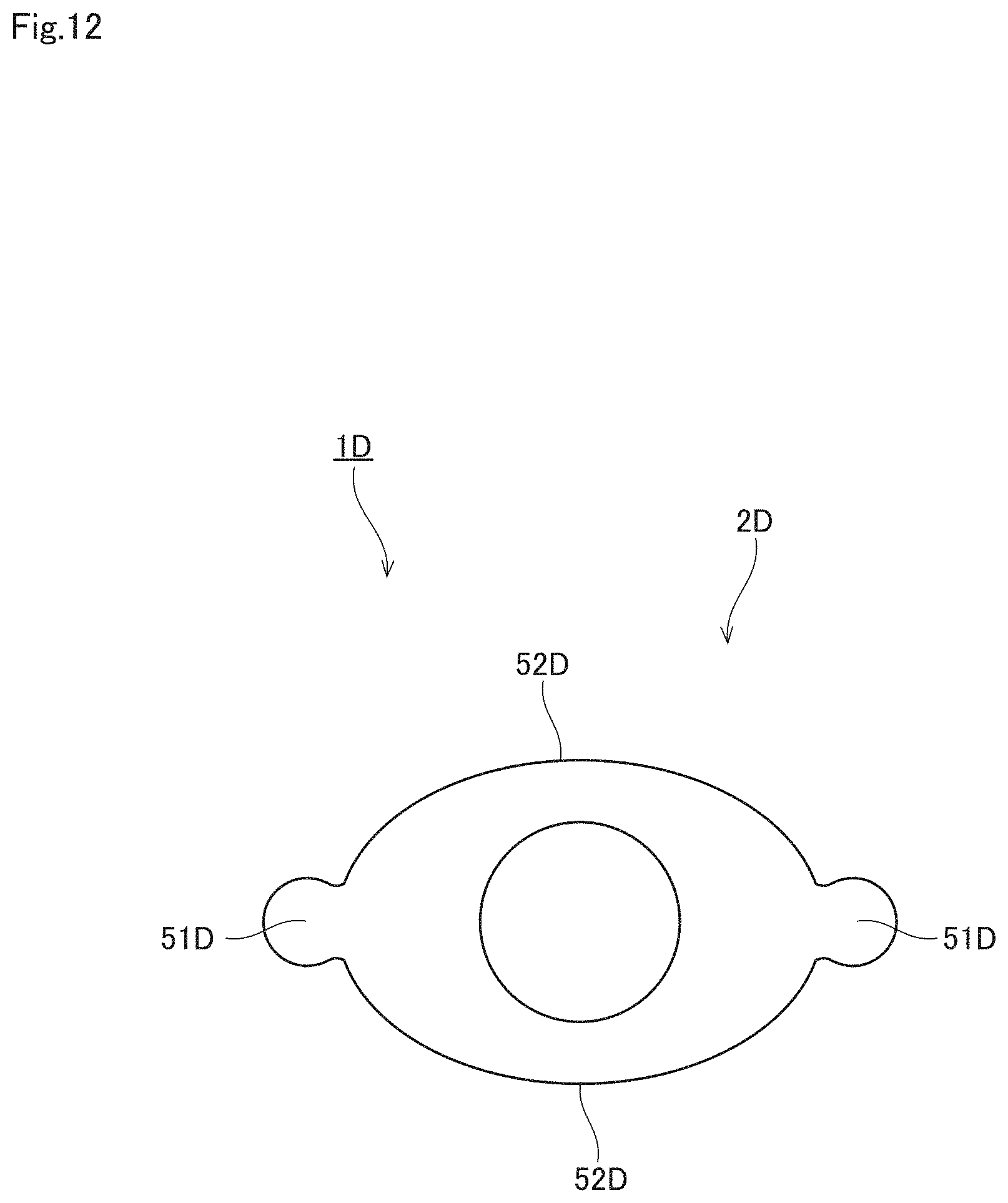 Patent US11771431 Figure 12 – Anastomosis assist tool and vascular anastomosis method