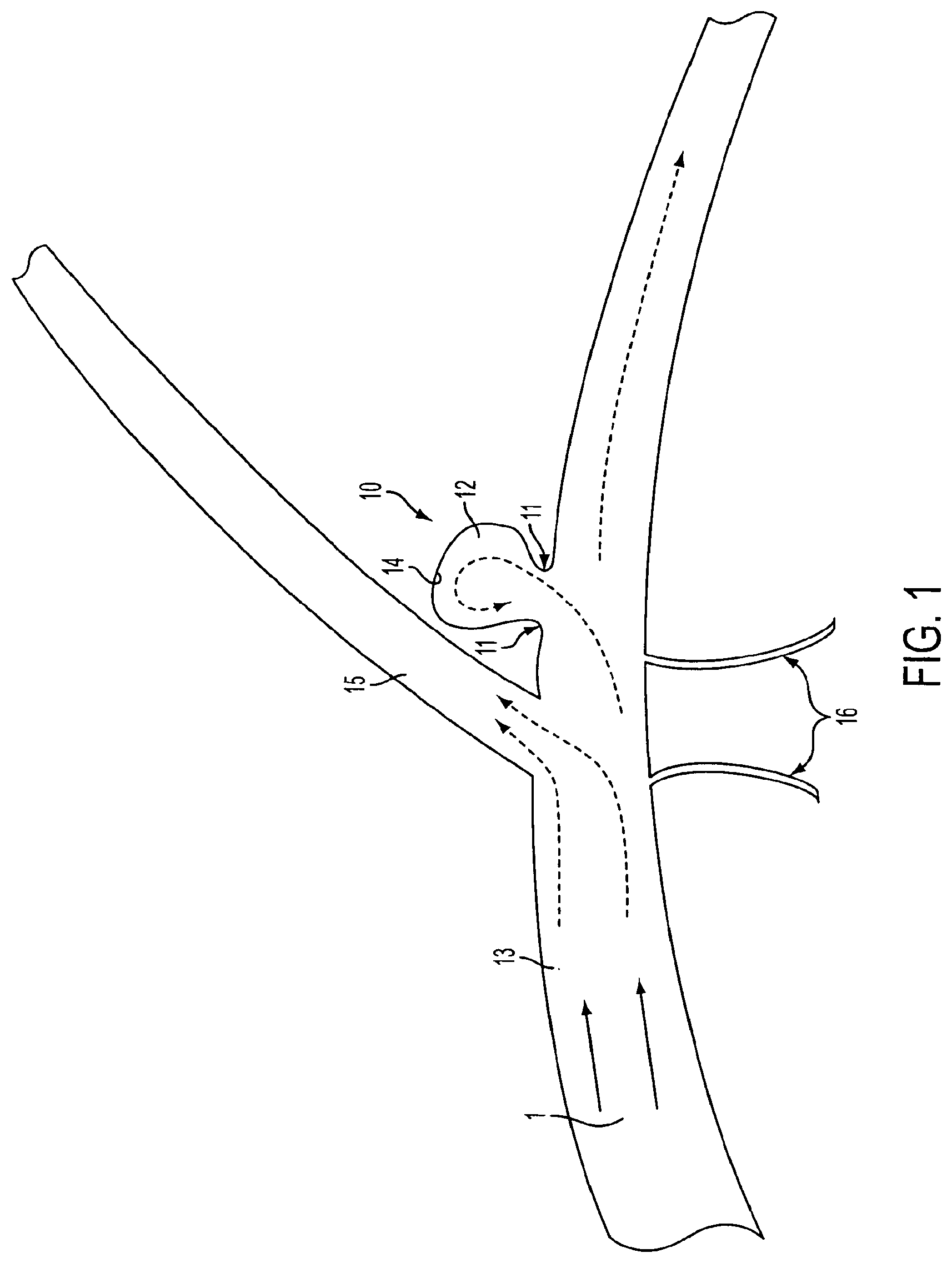 Patent US11771433 — Flexible vascular occluding device — Figure 1