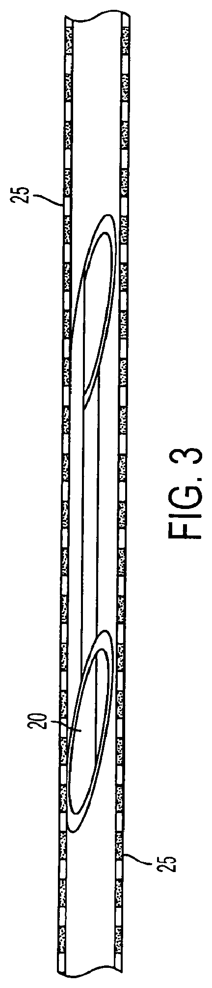 Patent US11771433 Figure 3 – Flexible vascular occluding device