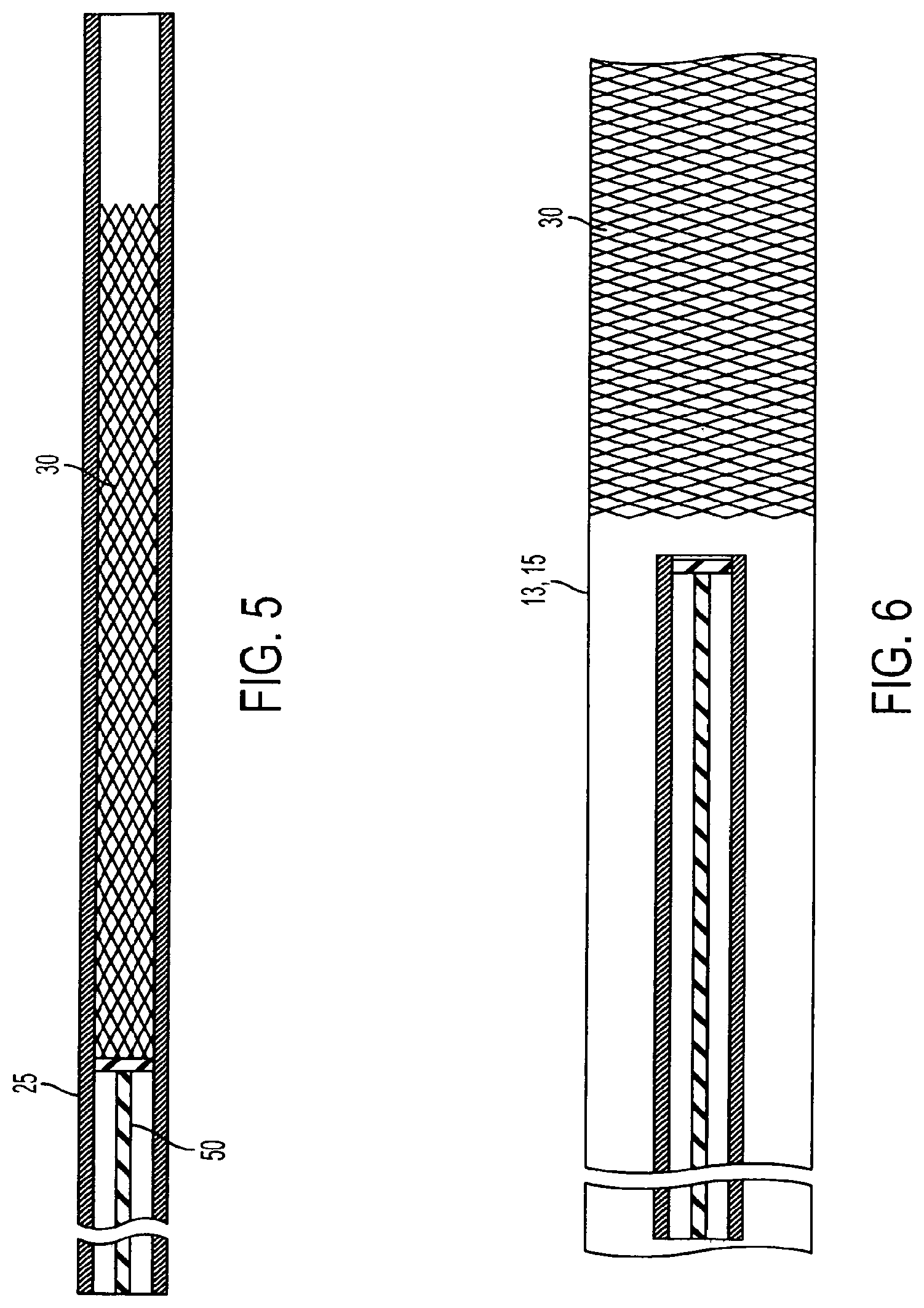 Patent US11771433 Figure 5 – Flexible vascular occluding device