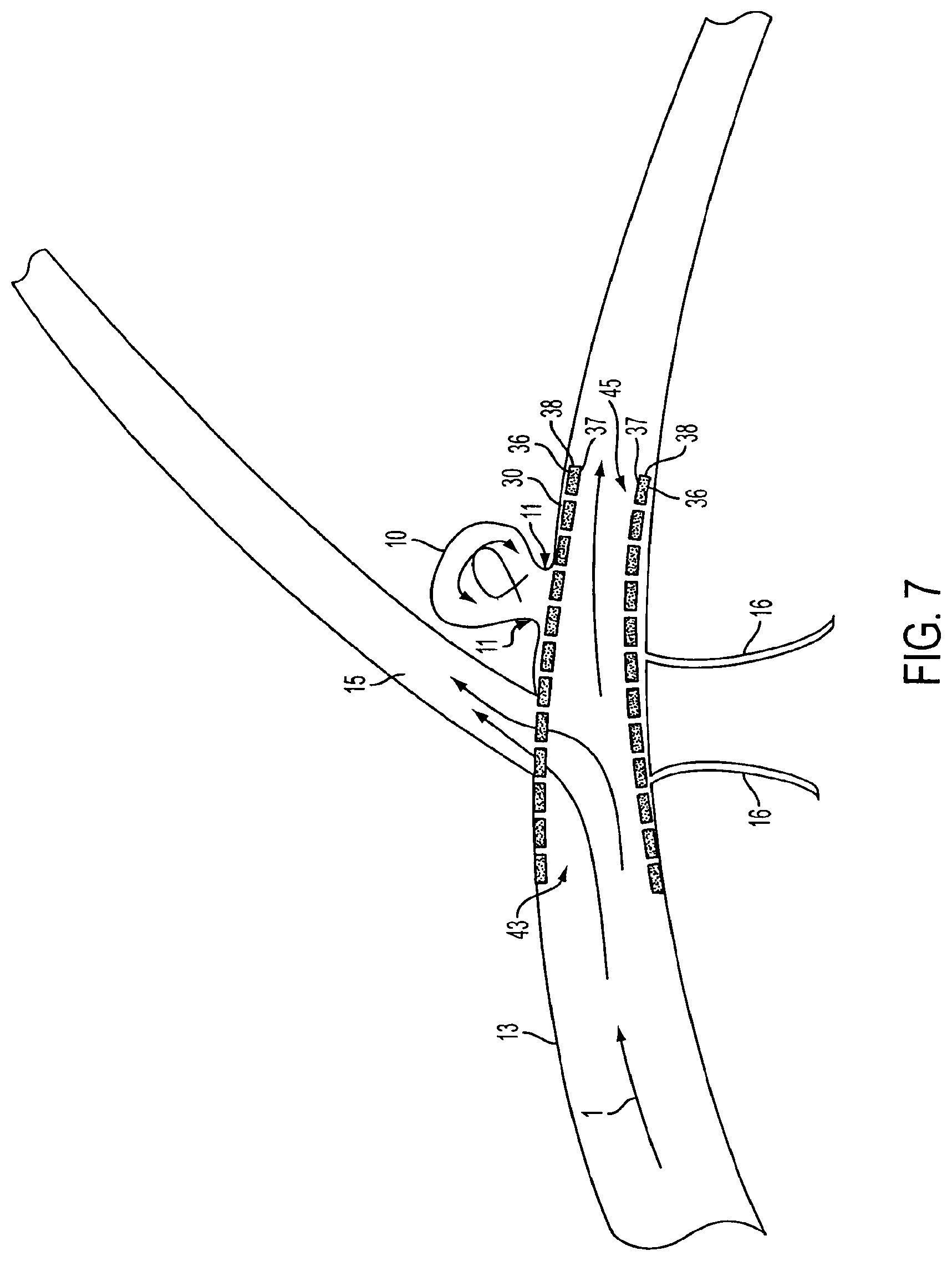 Patent US11771433 Figure 6 – Flexible vascular occluding device