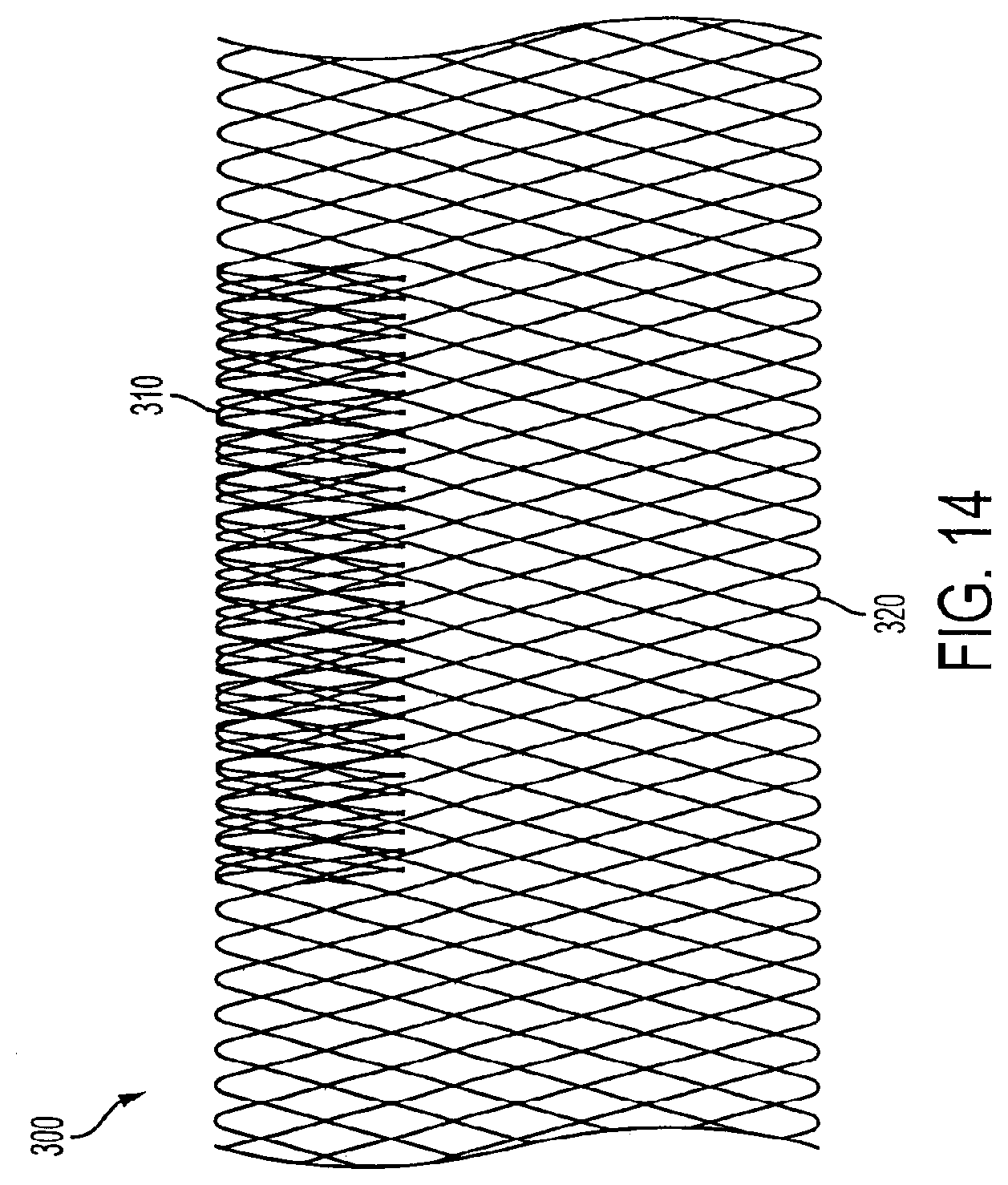 Patent US11771433 Figure 13 – Flexible vascular occluding device