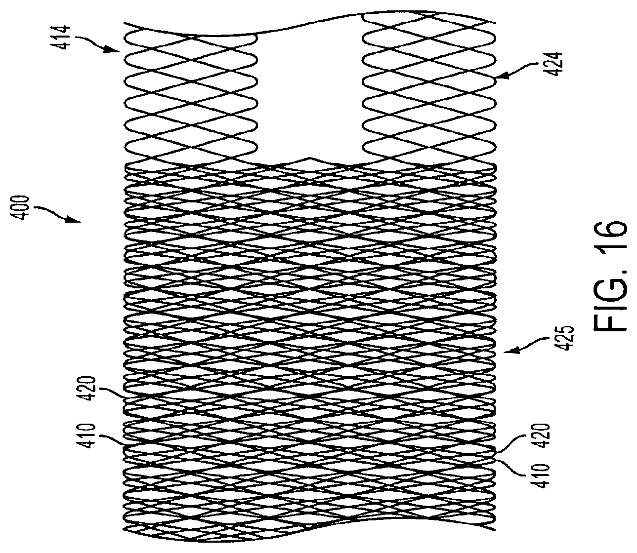 Patent US11771433 Figure 15 – Flexible vascular occluding device
