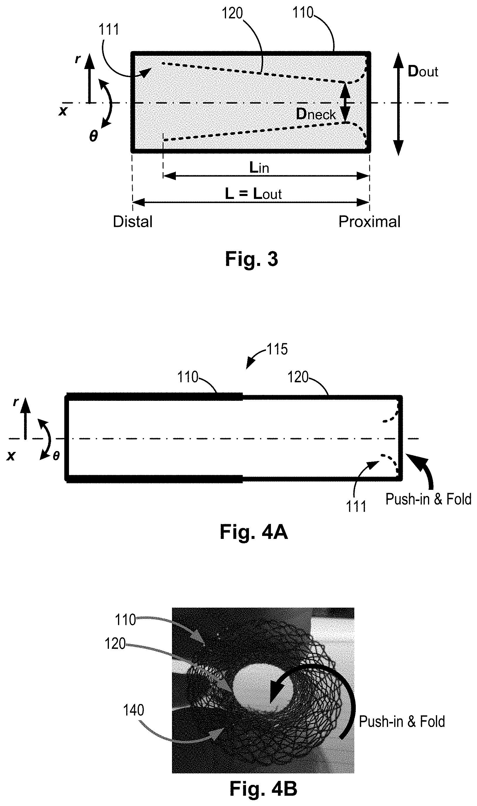 Patent US11771434 Figure 2 – Artery medical apparatus and methods of use thereof