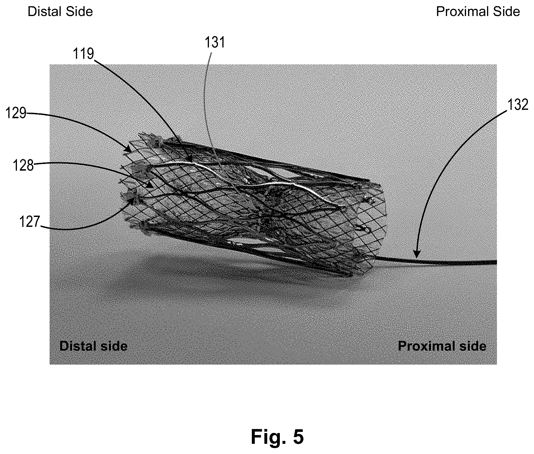 Patent US11771434 Figure 3 – Artery medical apparatus and methods of use thereof