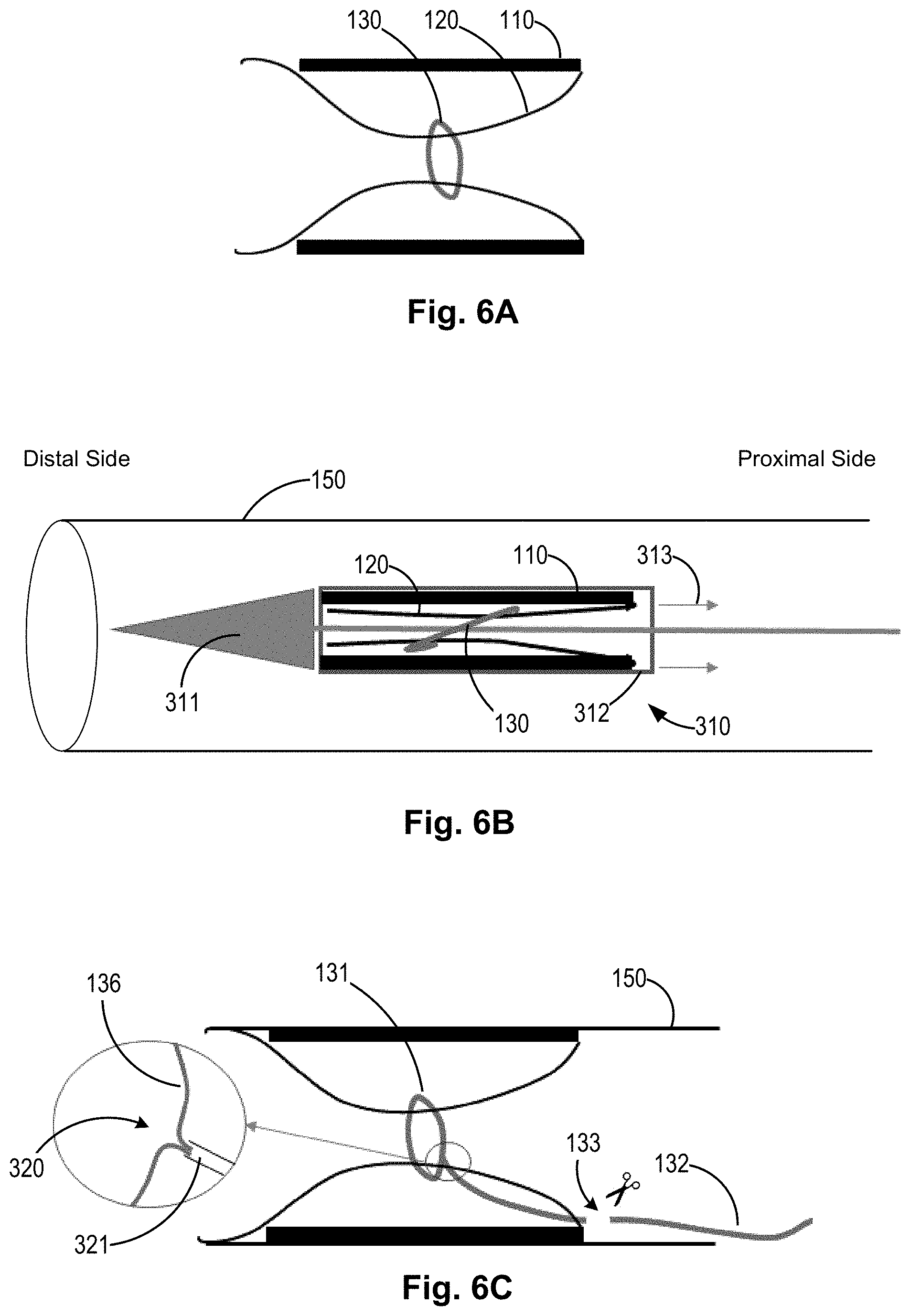 Patent US11771434 Figure 4 – Artery medical apparatus and methods of use thereof