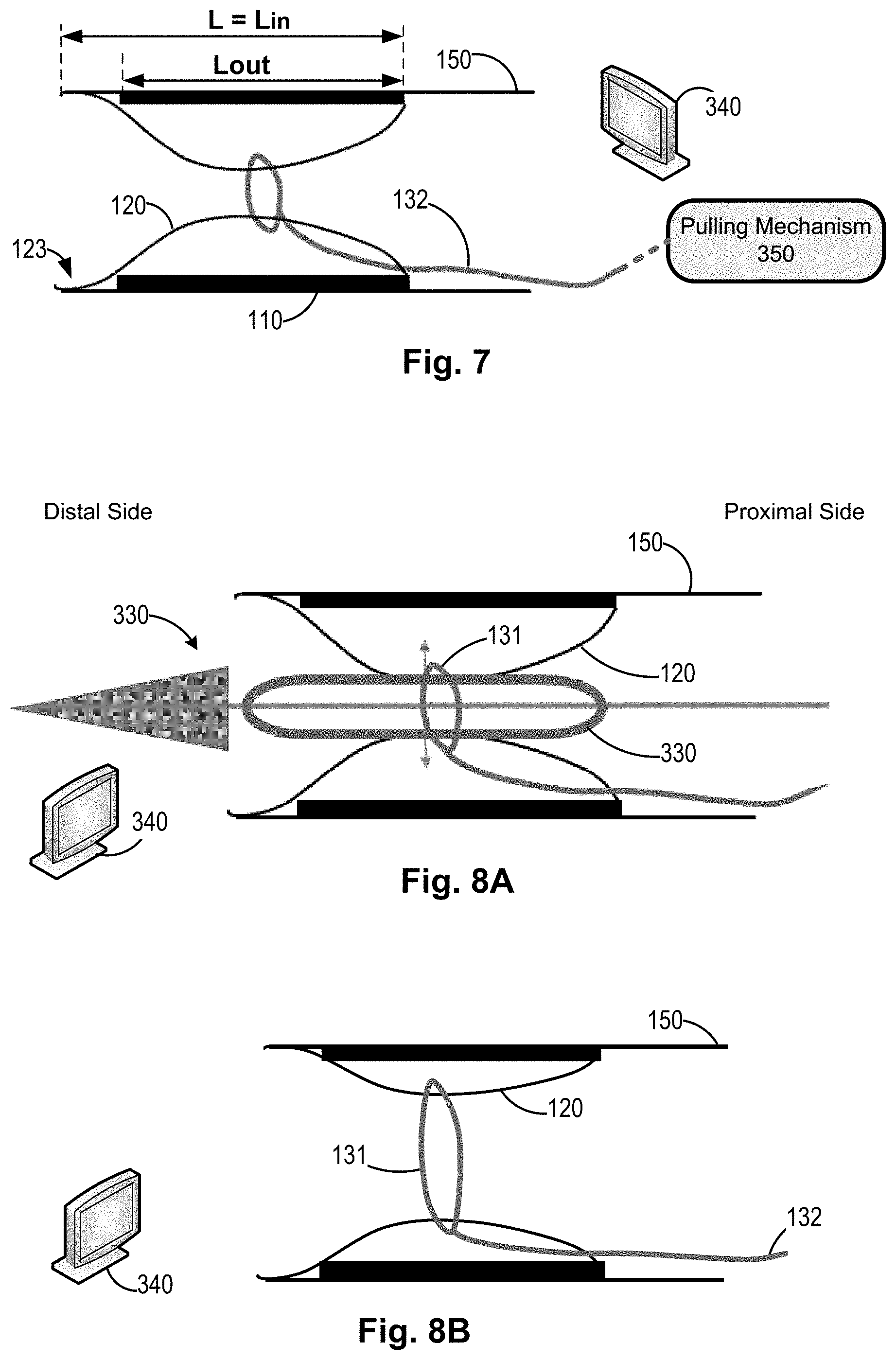 Patent US11771434 Figure 5 – Artery medical apparatus and methods of use thereof