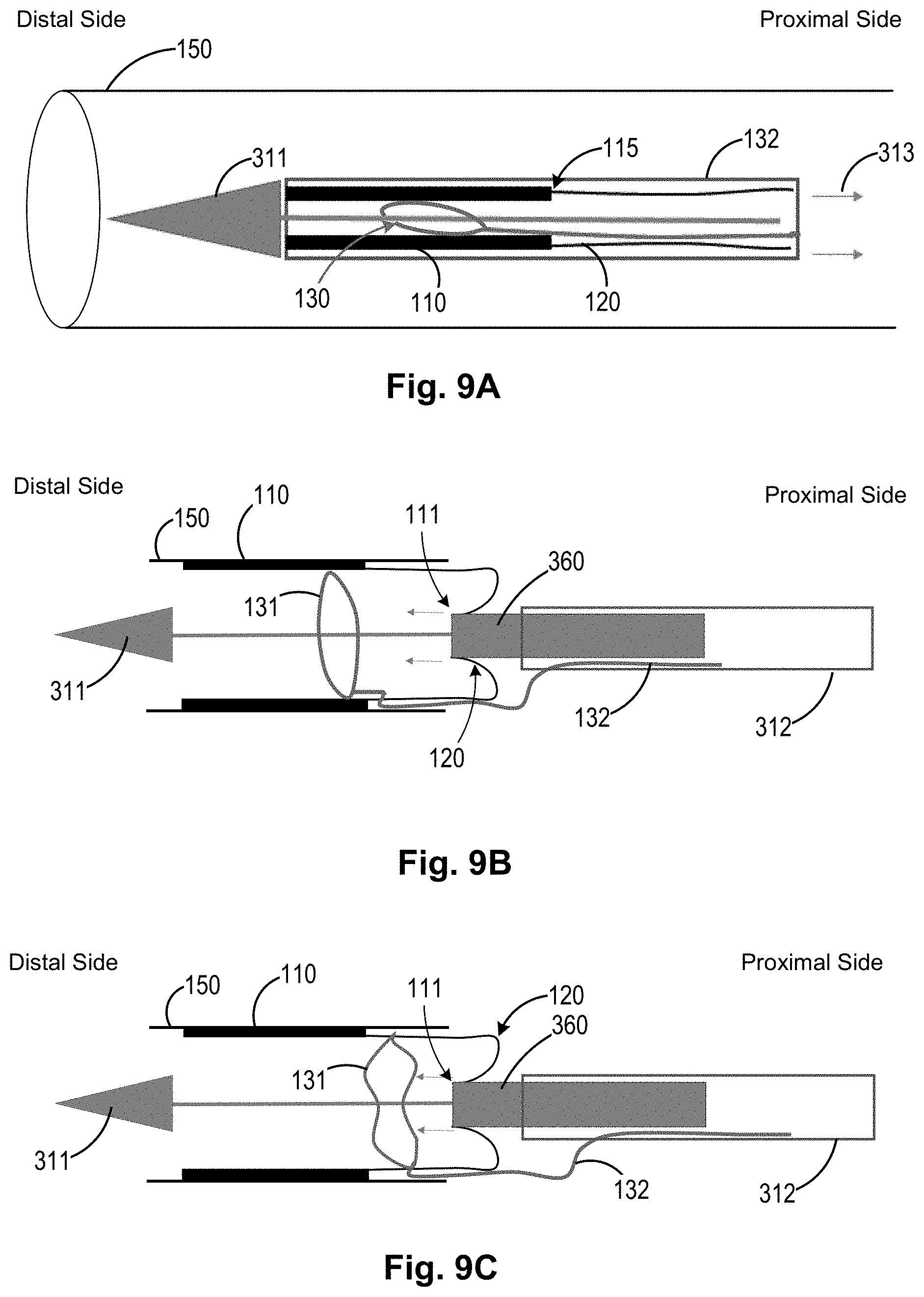 Patent US11771434 Figure 6 – Artery medical apparatus and methods of use thereof