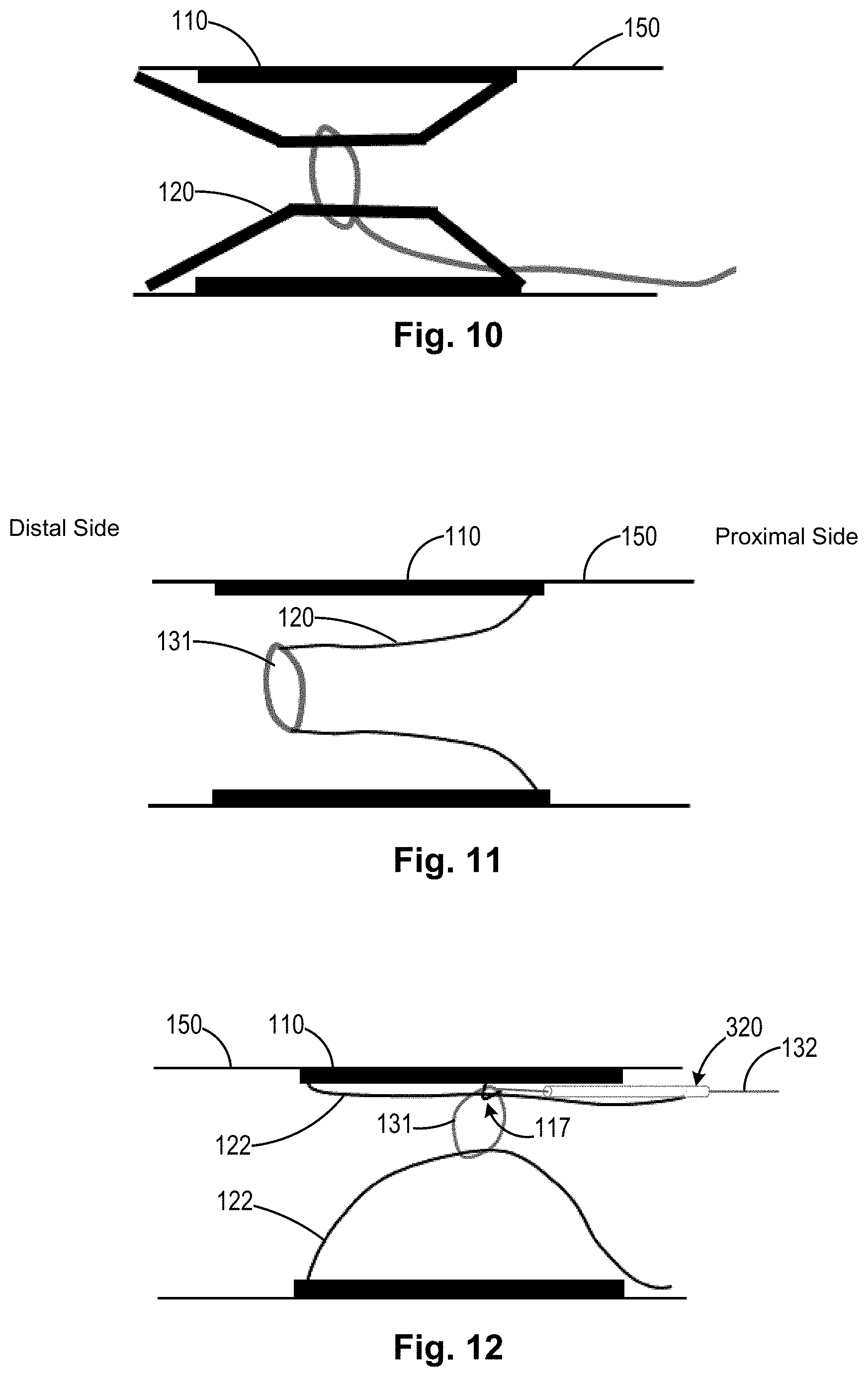 Patent US11771434 Figure 7 – Artery medical apparatus and methods of use thereof