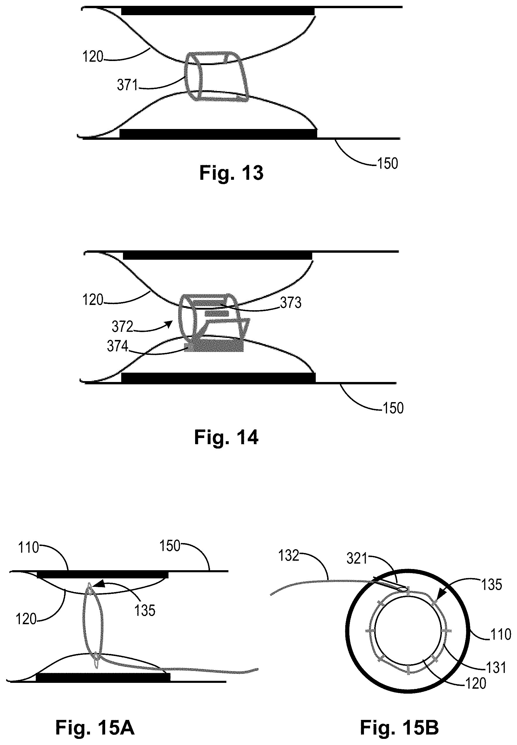 Patent US11771434 Figure 8 – Artery medical apparatus and methods of use thereof