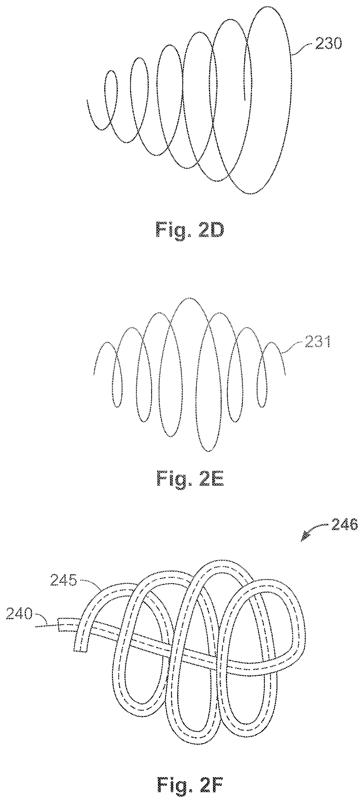 Patent US11771435 Figure 3 – Expandable implant and implant system