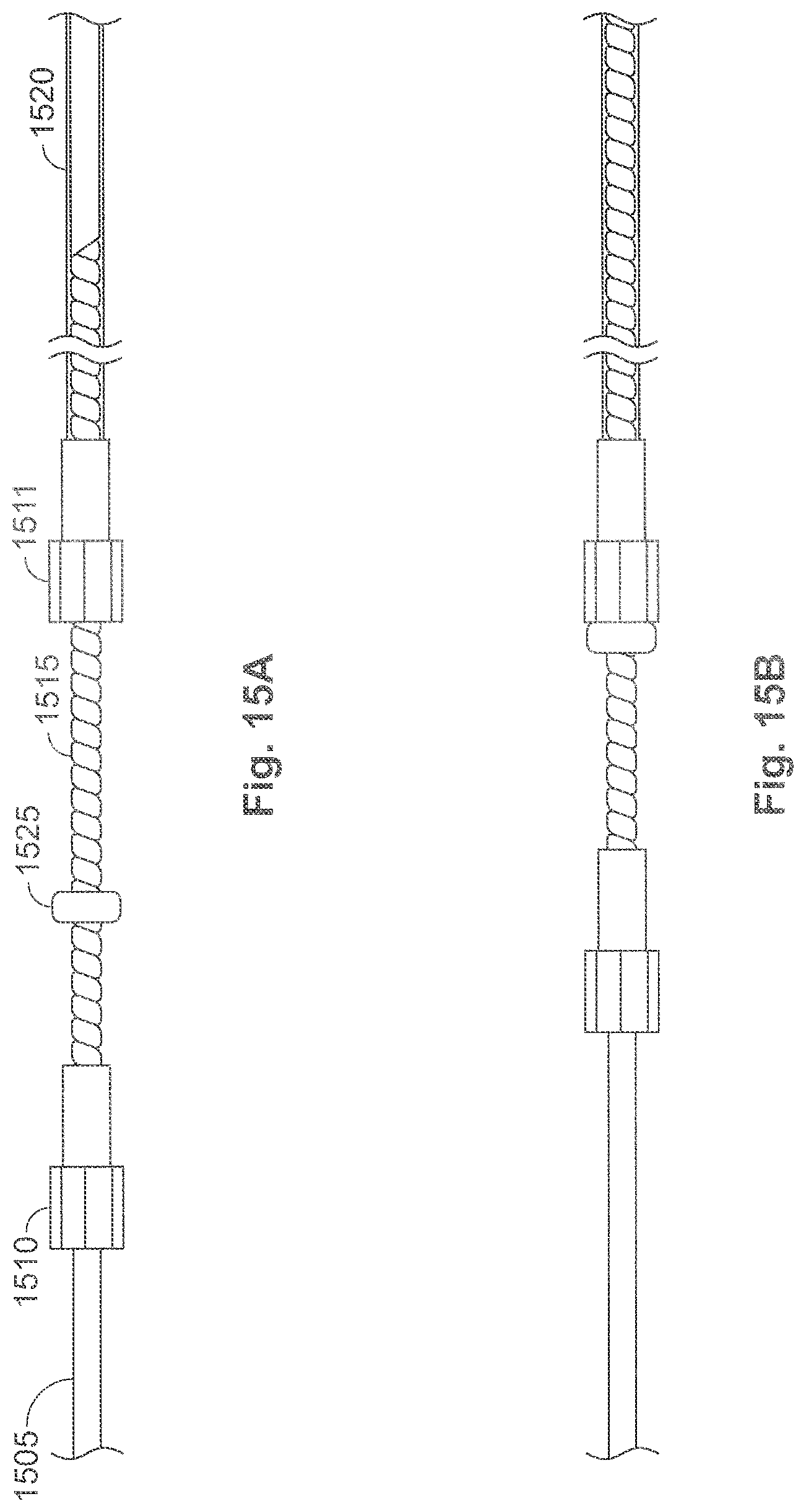 Patent US11771435 Figure 13 – Expandable implant and implant system