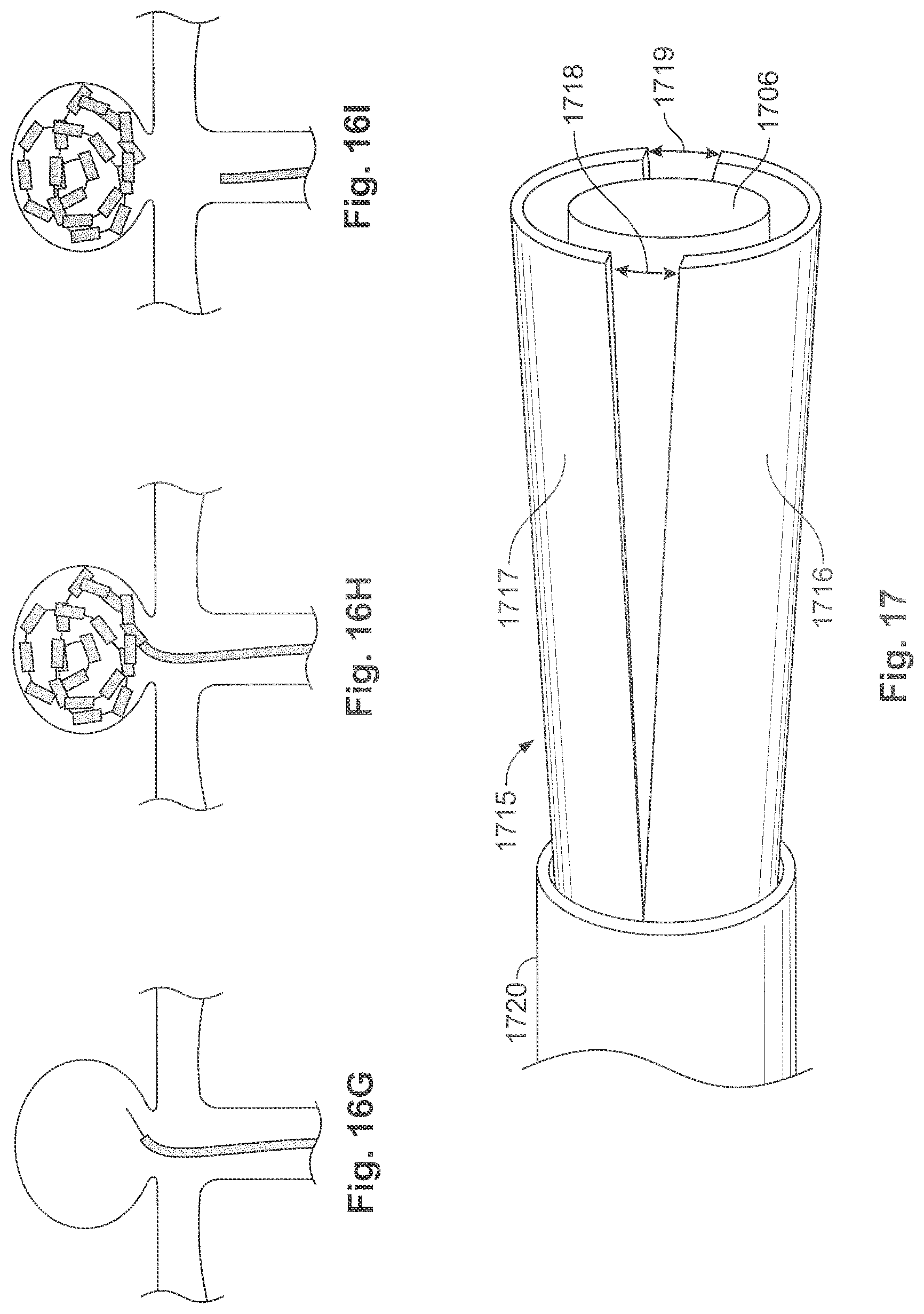 Patent US11771435 Figure 15 – Expandable implant and implant system