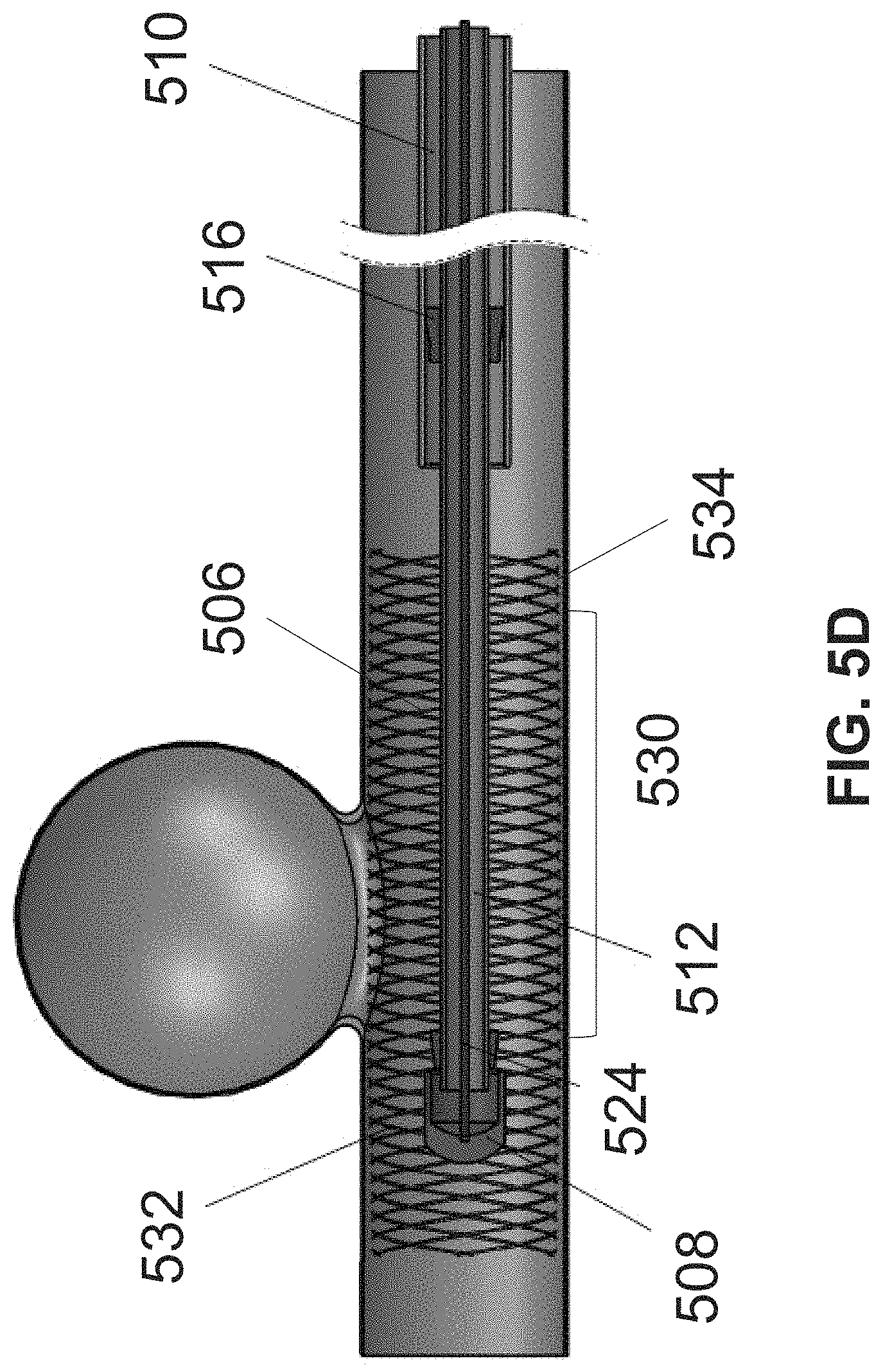 Patent US11771436 Figure 9 – Aneurysm treatment device and method