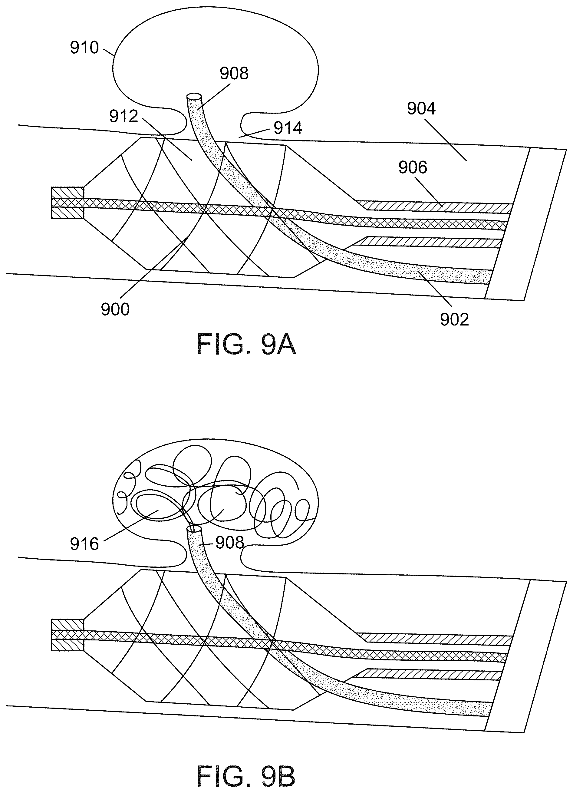 Patent US11771436 Figure 13 – Aneurysm treatment device and method