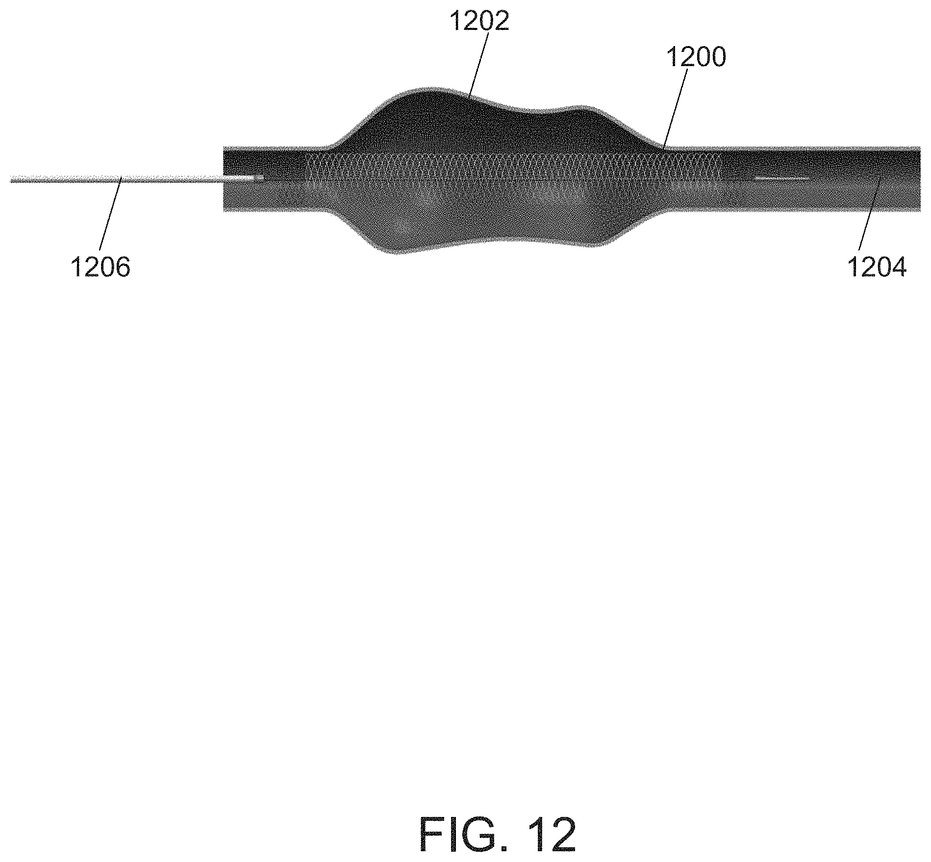Patent US11771436 Figure 16 – Aneurysm treatment device and method