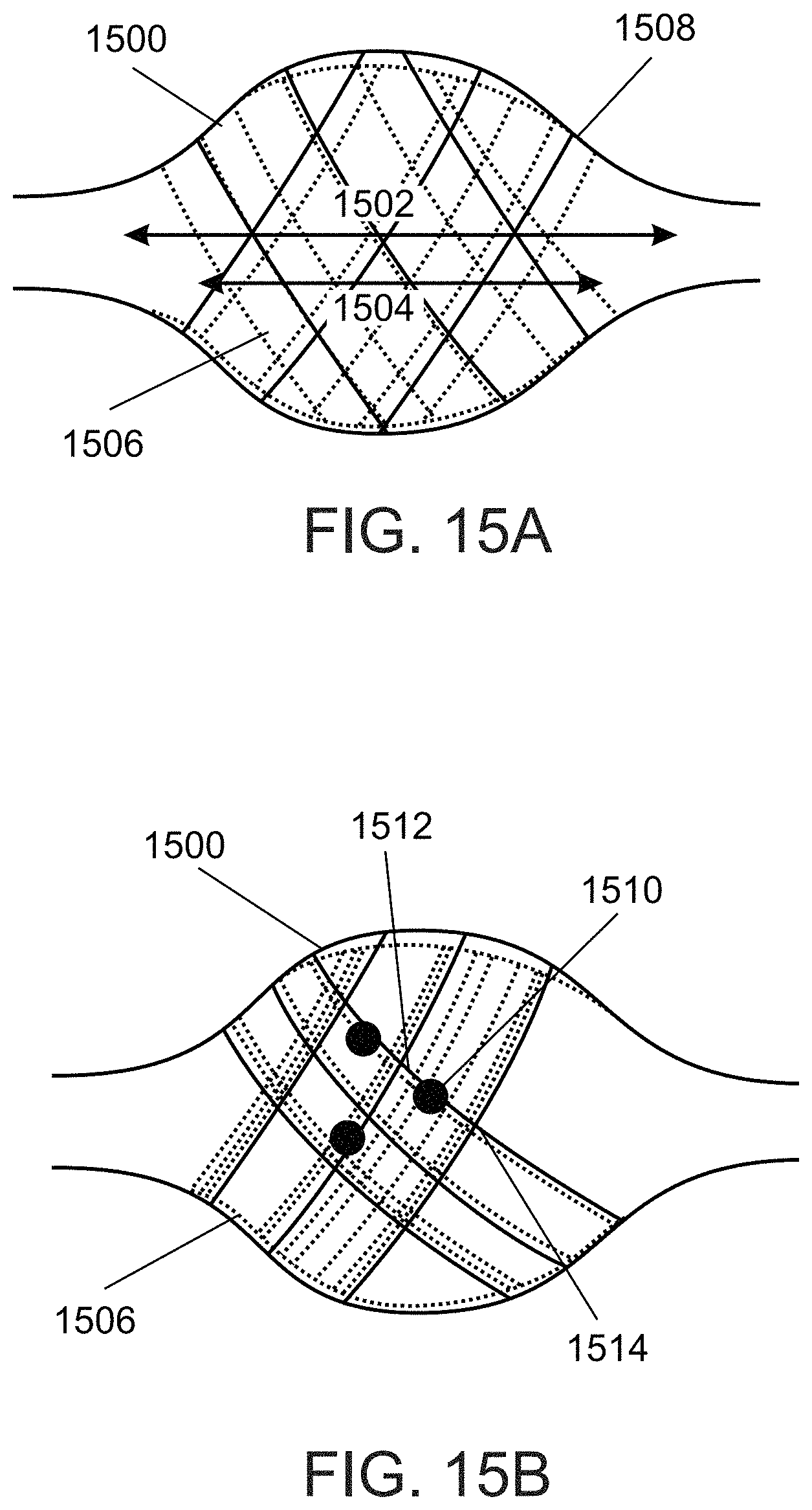 Patent US11771436 Figure 19 – Aneurysm treatment device and method