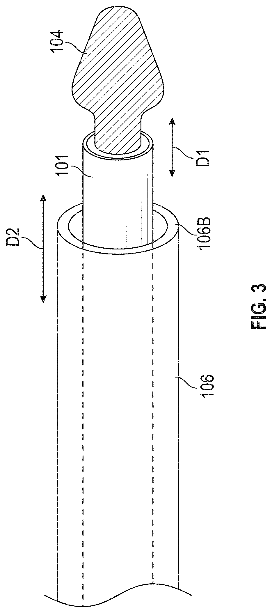 Patent US11771440 Figure 3 – Burring devices, systems, and methods