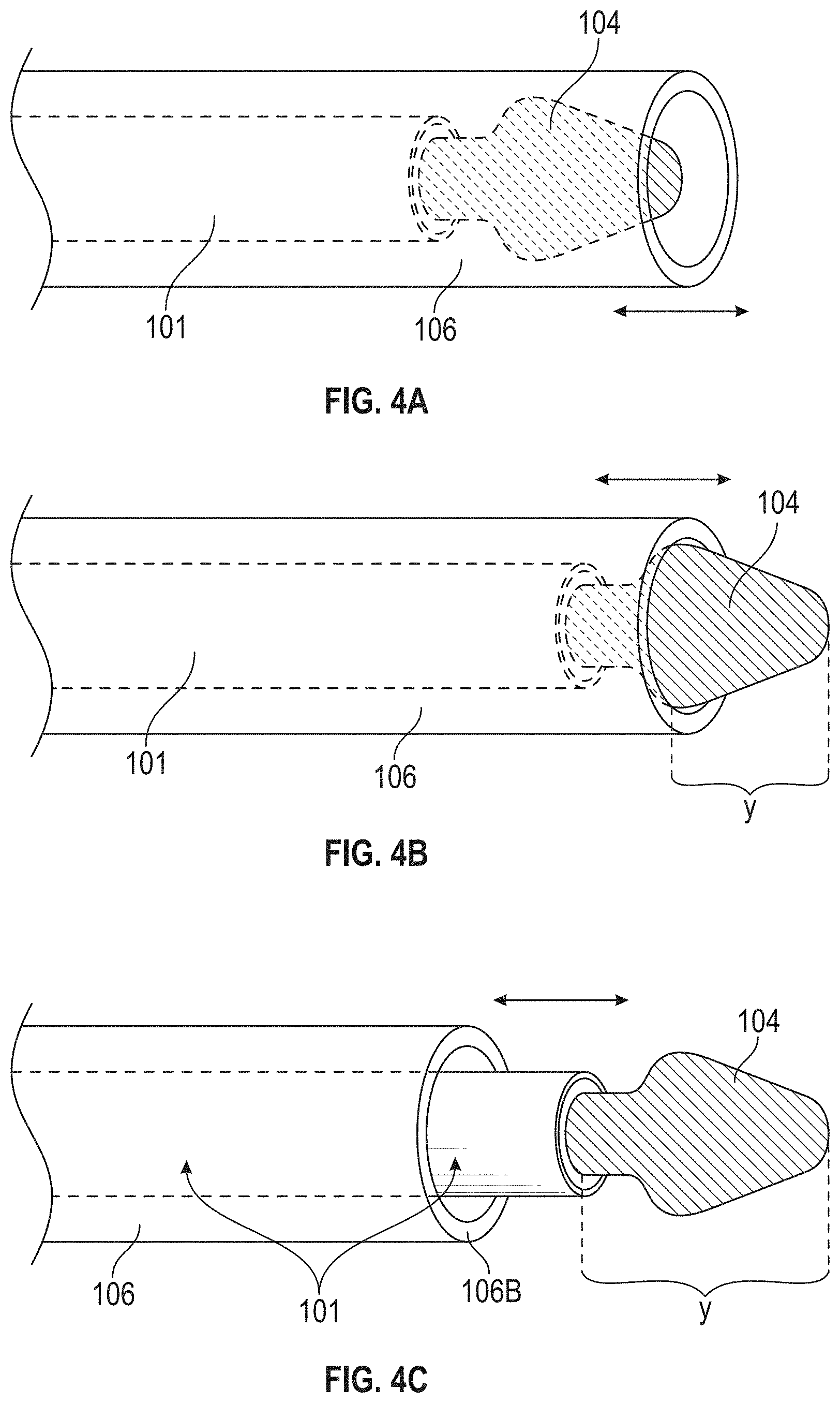 Patent US11771440 Figure 4 – Burring devices, systems, and methods