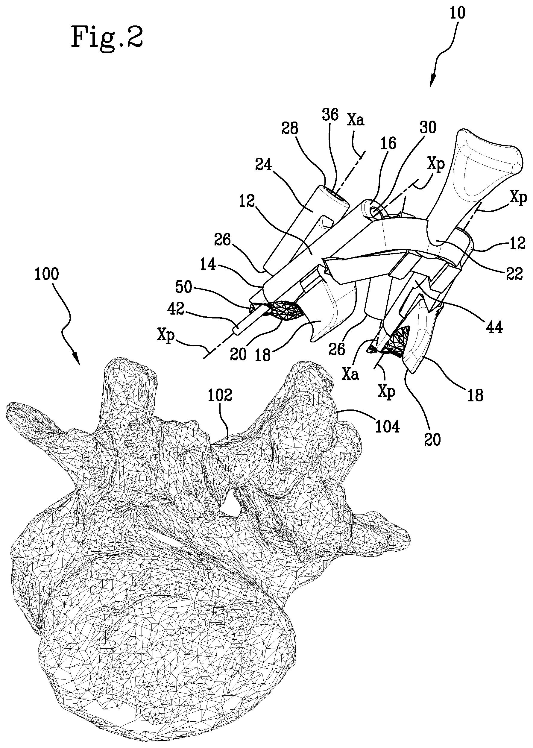Patent US11771441 Figure 2 – Specific disposable guide device for spinal surgery