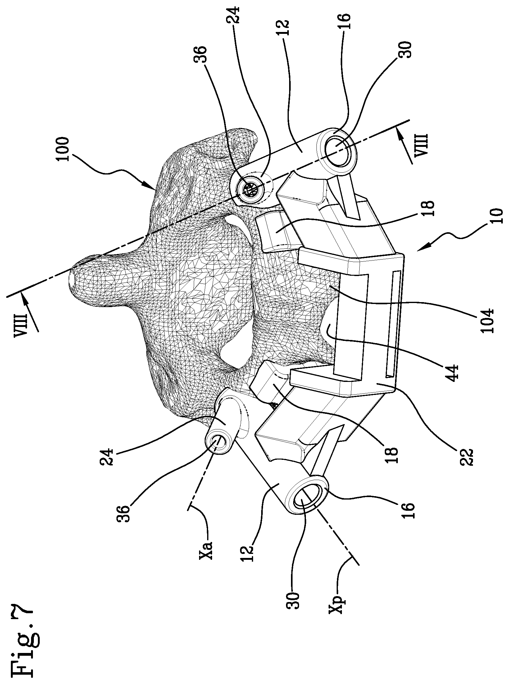 Patent US11771441 Figure 7 – Specific disposable guide device for spinal surgery
