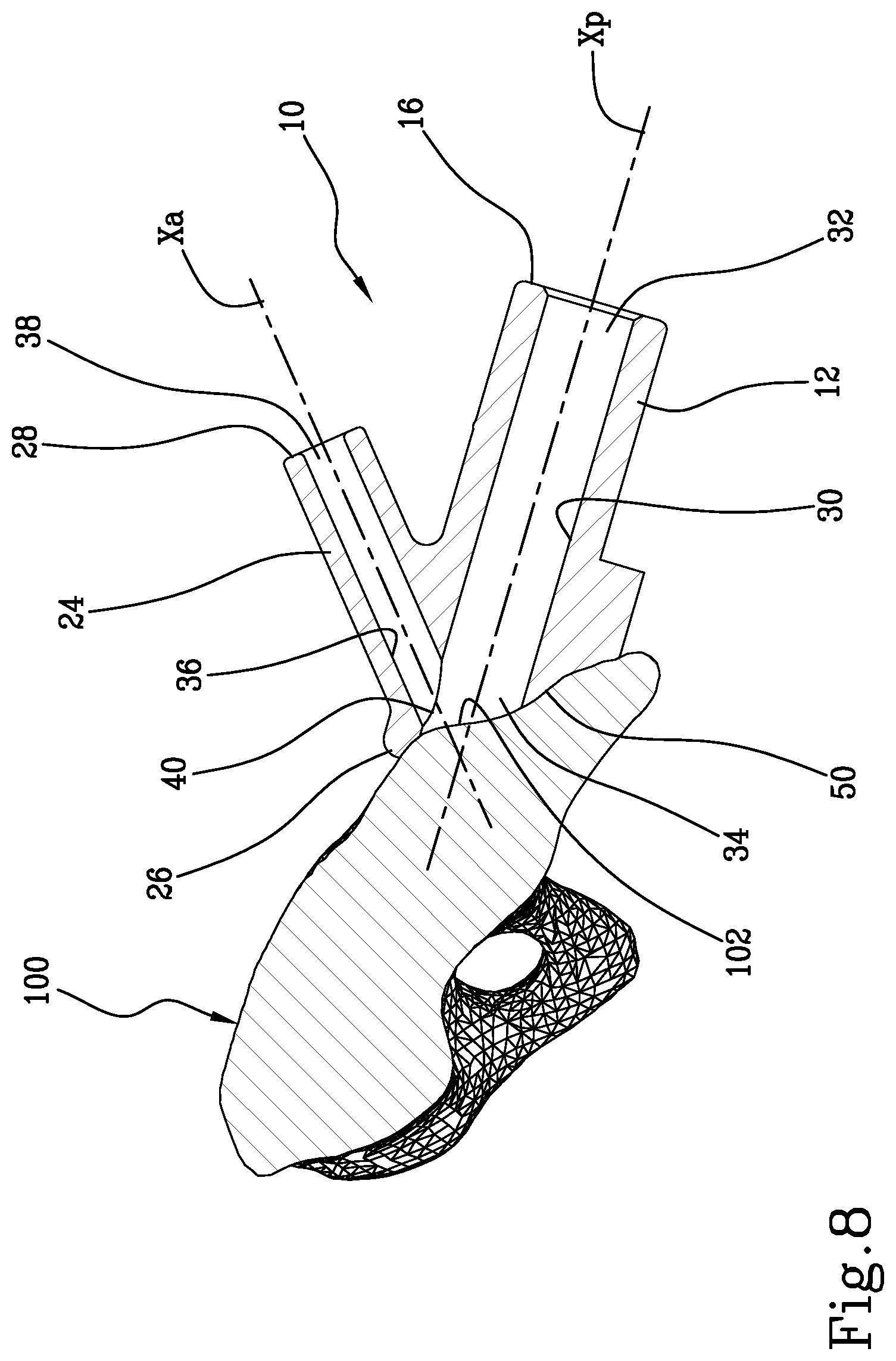 Patent US11771441 Figure 8 – Specific disposable guide device for spinal surgery