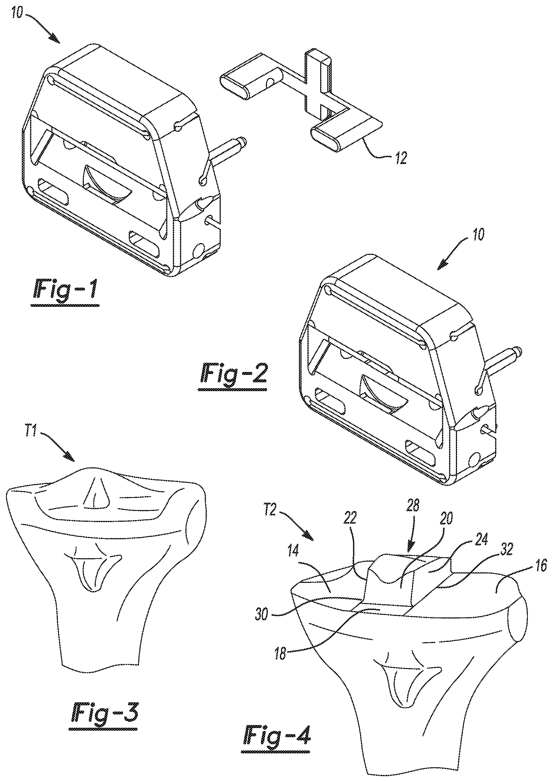 Patent US11771442 — Bi-cruciate knee system — Figure 1