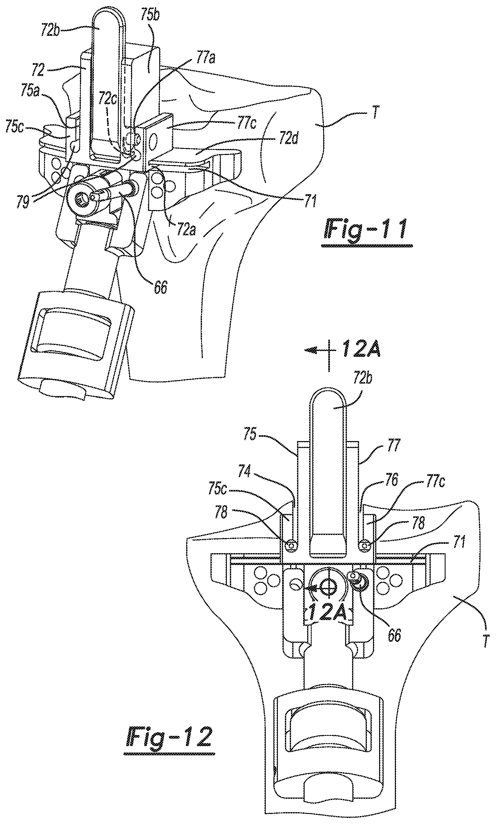 Patent US11771442 Figure 5 – Bi-cruciate knee system