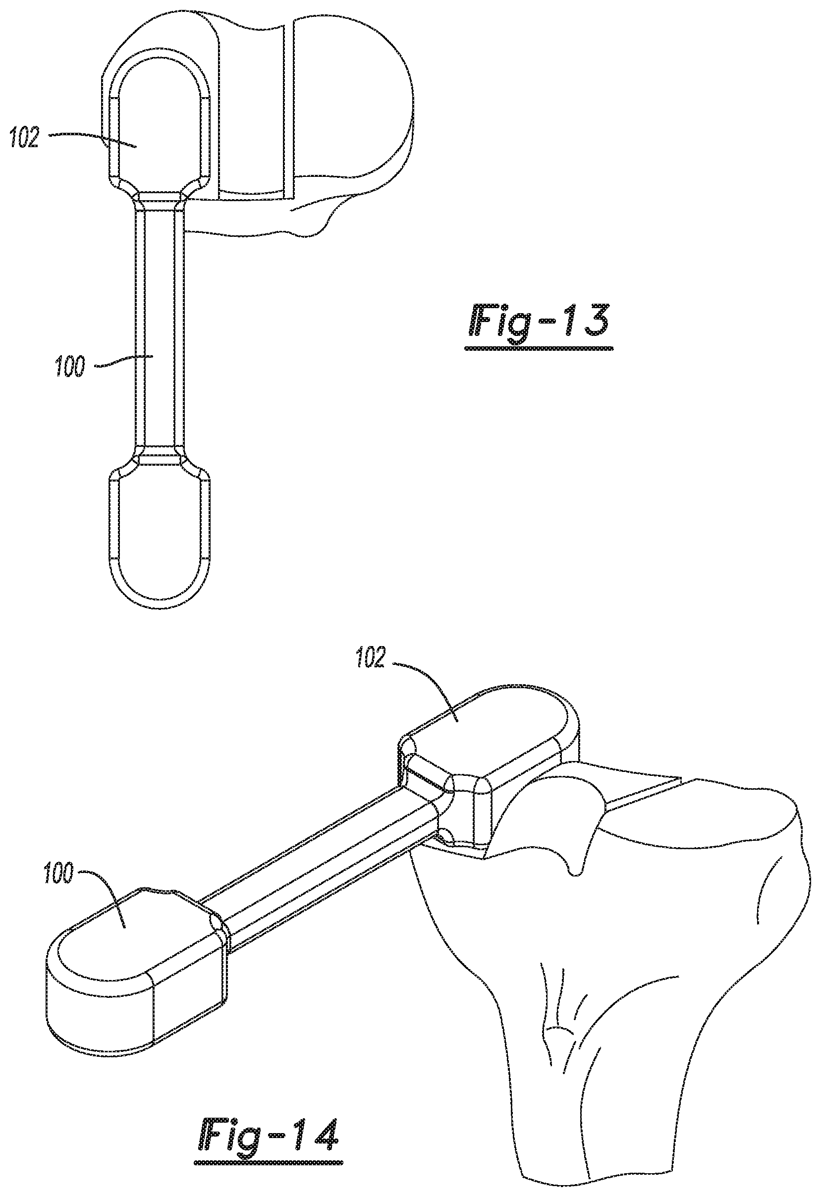 Patent US11771442 Figure 7 – Bi-cruciate knee system