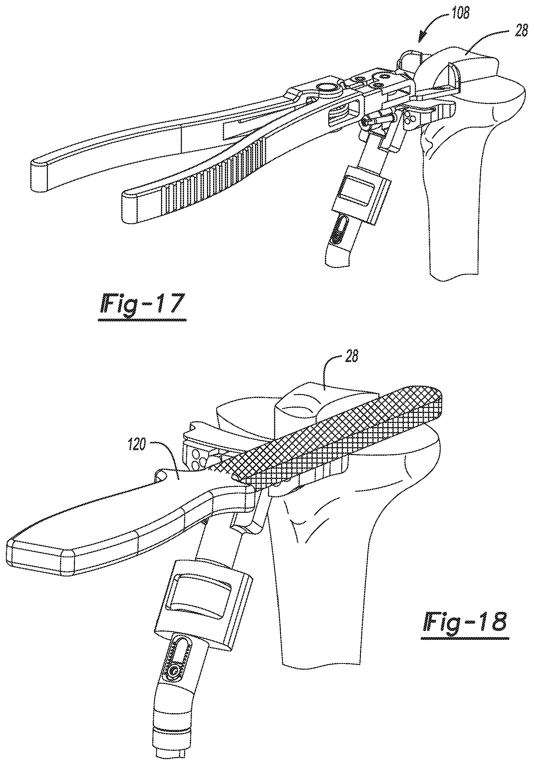 Patent US11771442 Figure 9 – Bi-cruciate knee system