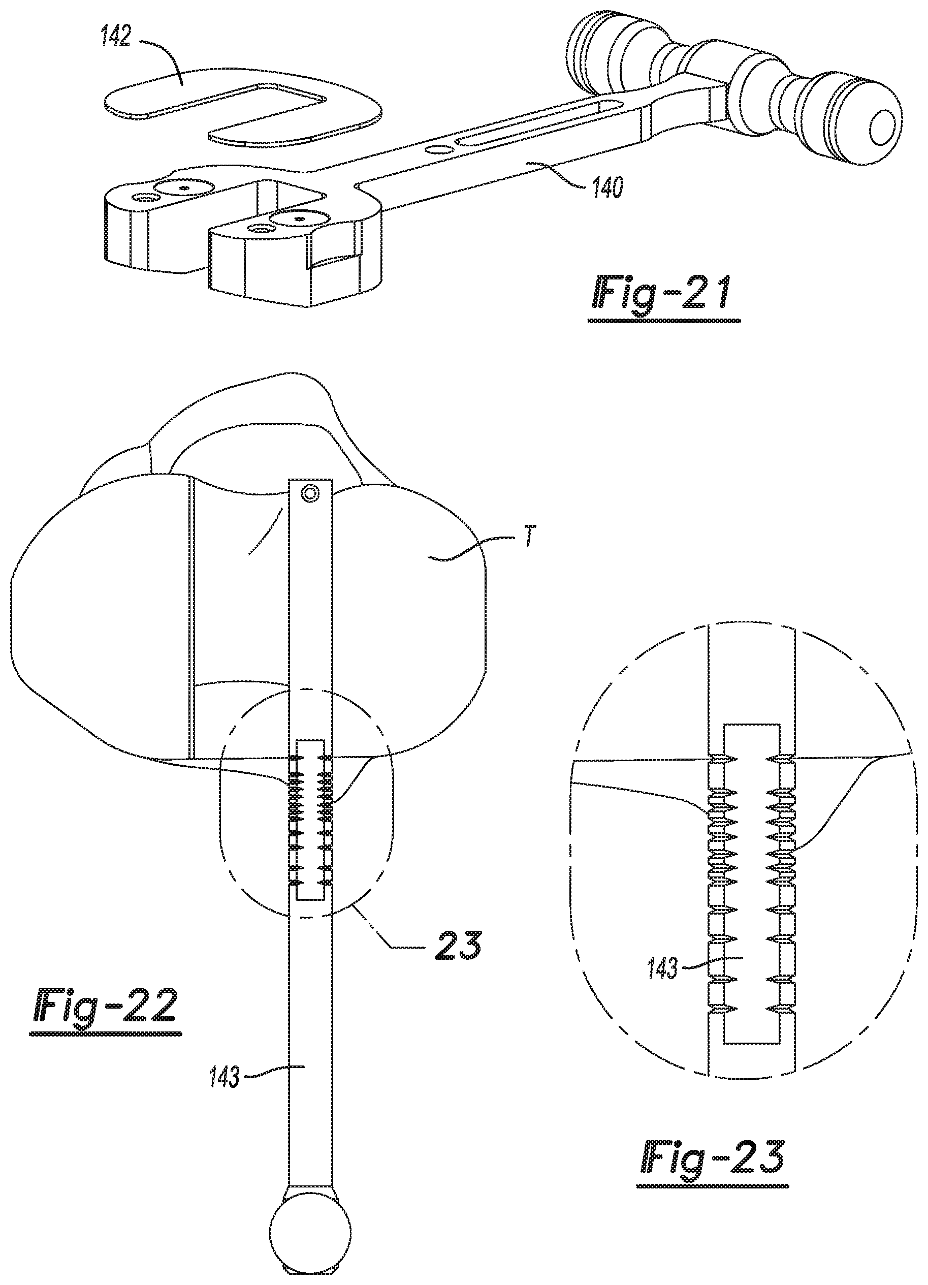 Patent US11771442 Figure 11 – Bi-cruciate knee system