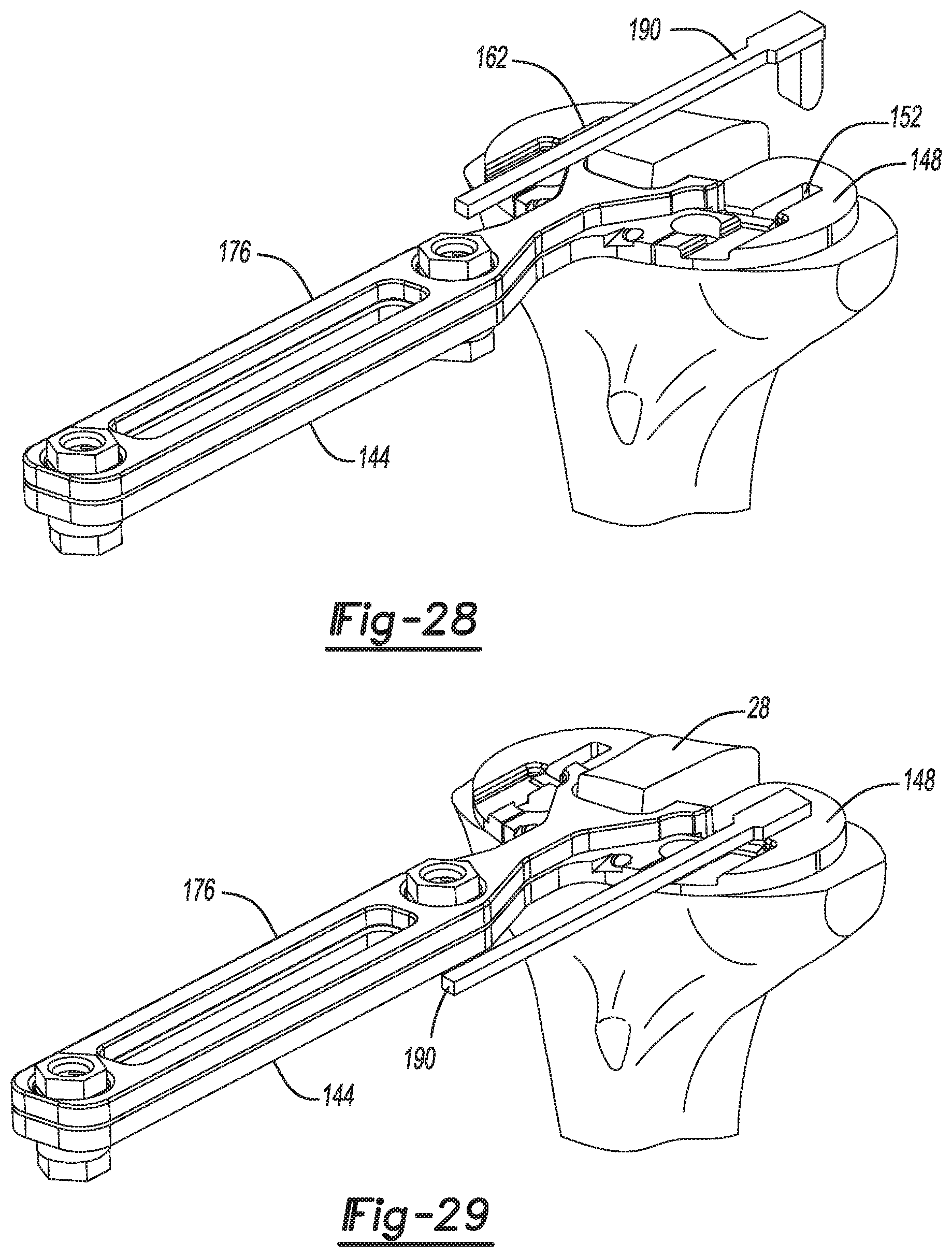 Patent US11771442 Figure 14 – Bi-cruciate knee system
