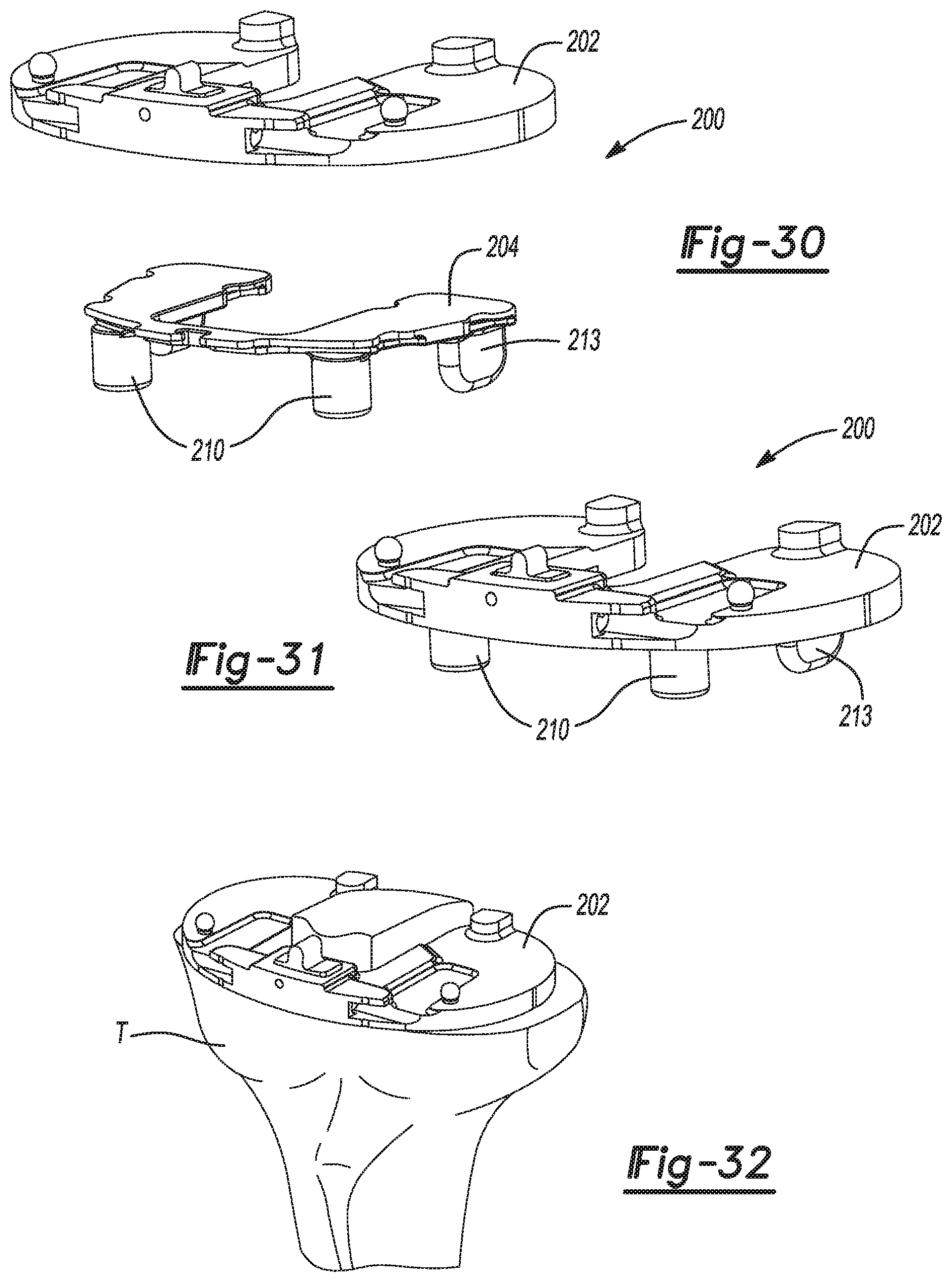 Patent US11771442 Figure 15 – Bi-cruciate knee system