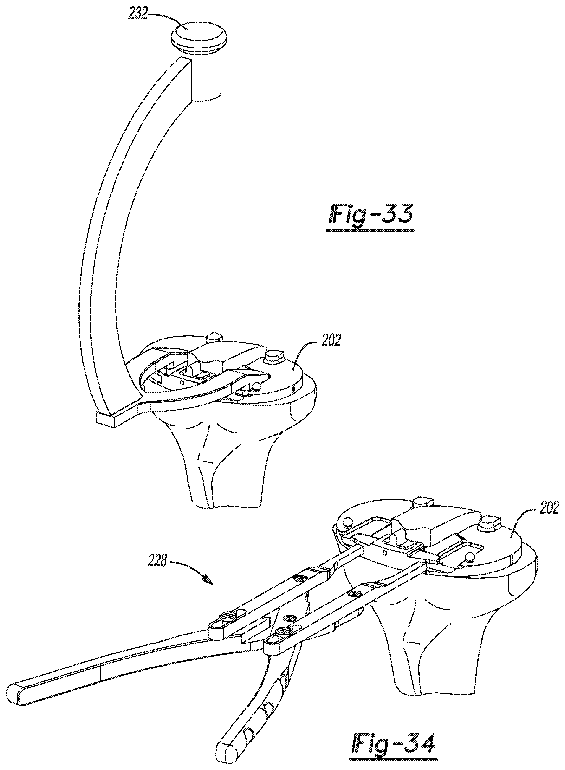 Patent US11771442 Figure 16 – Bi-cruciate knee system