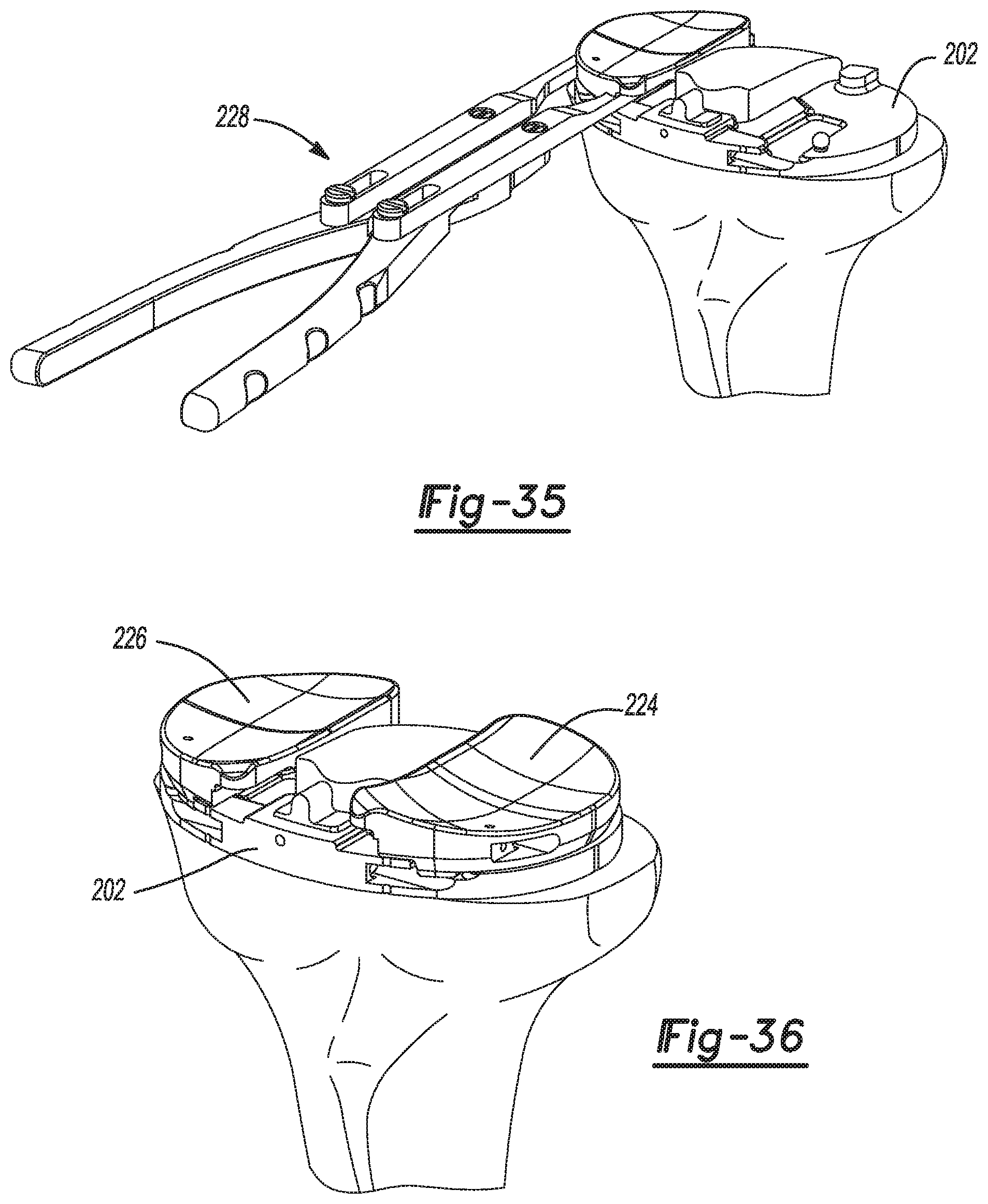 Patent US11771442 Figure 17 – Bi-cruciate knee system