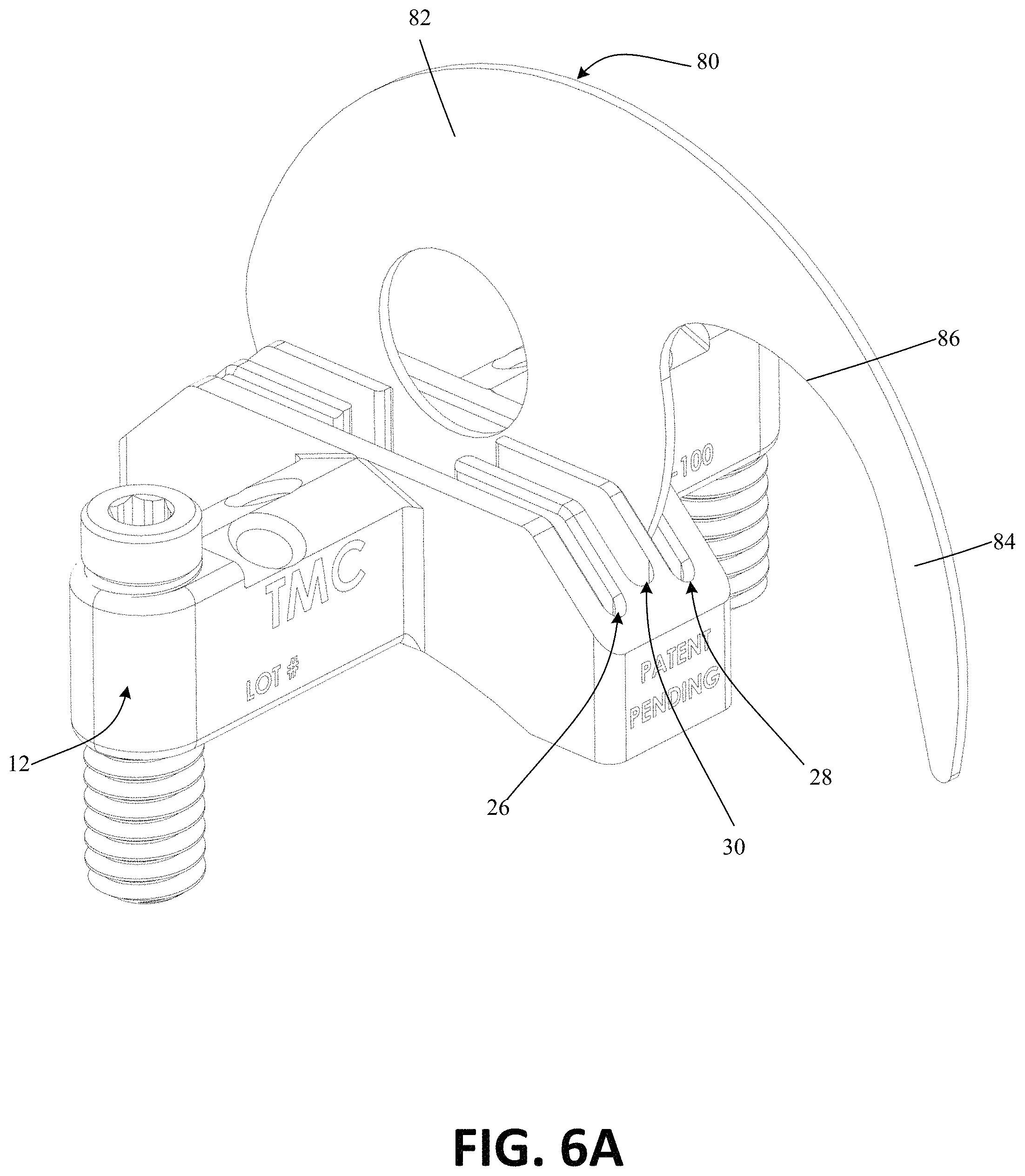 Patent US11771443 Figure 12 – Joint spacer systems and methods
