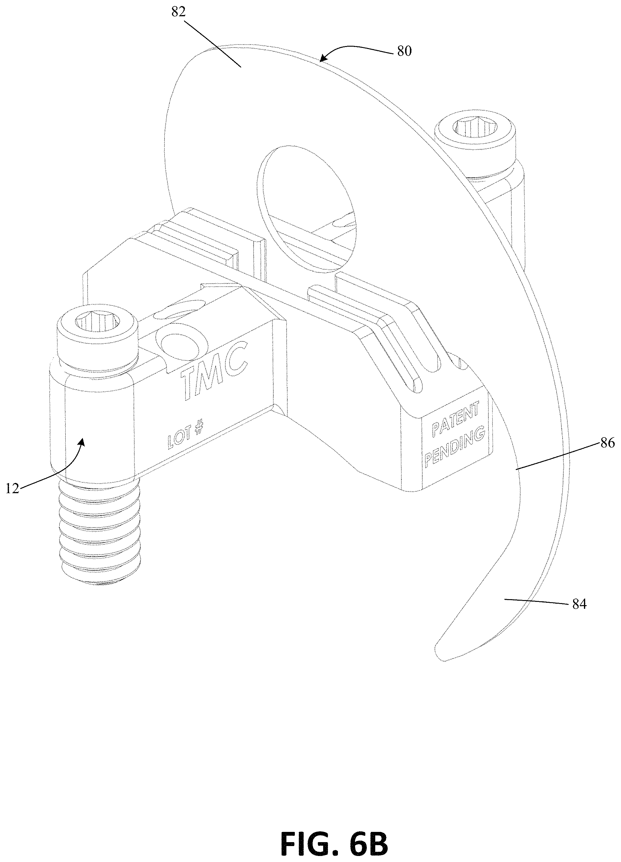 Patent US11771443 Figure 13 – Joint spacer systems and methods
