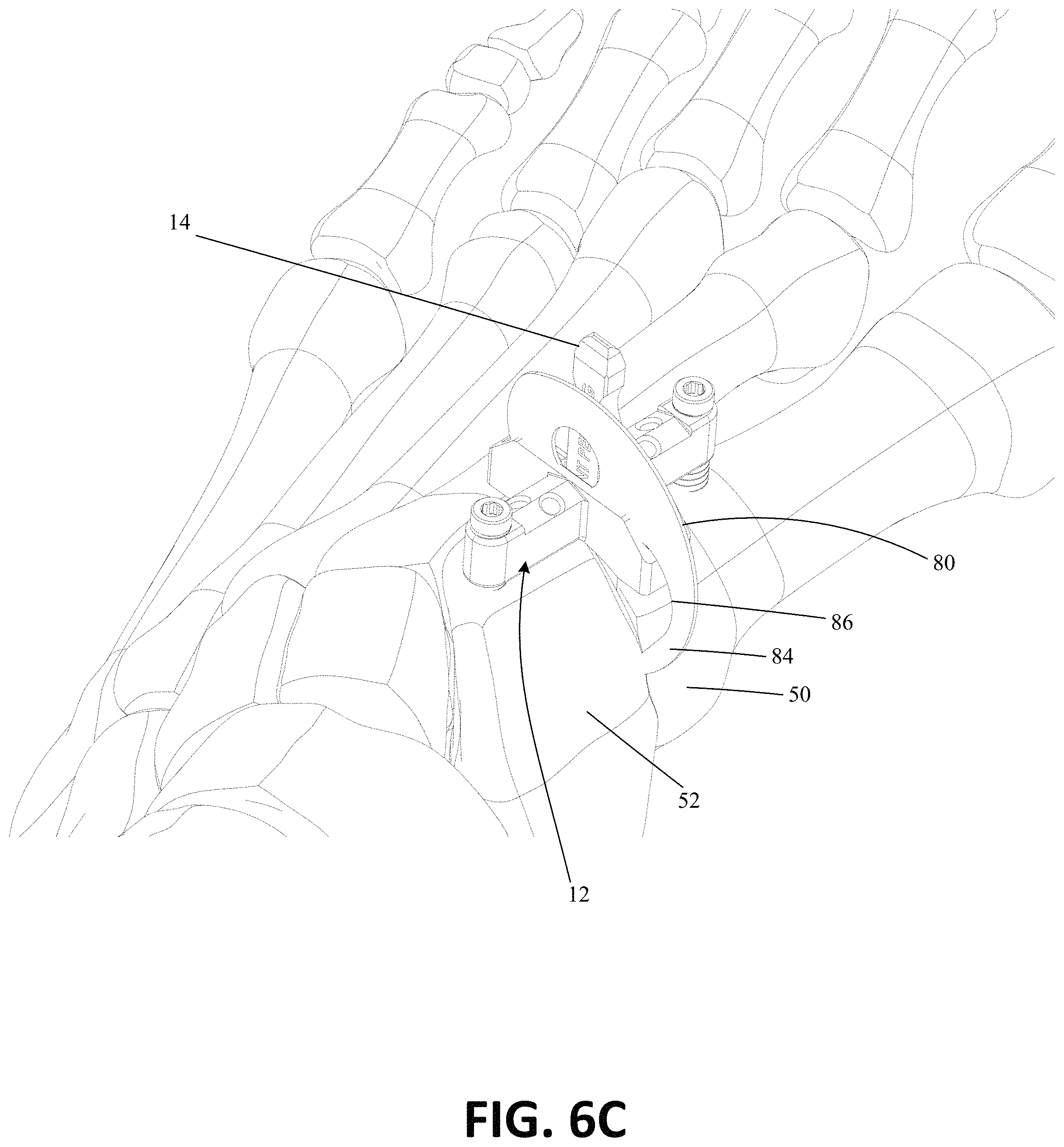Patent US11771443 Figure 14 – Joint spacer systems and methods