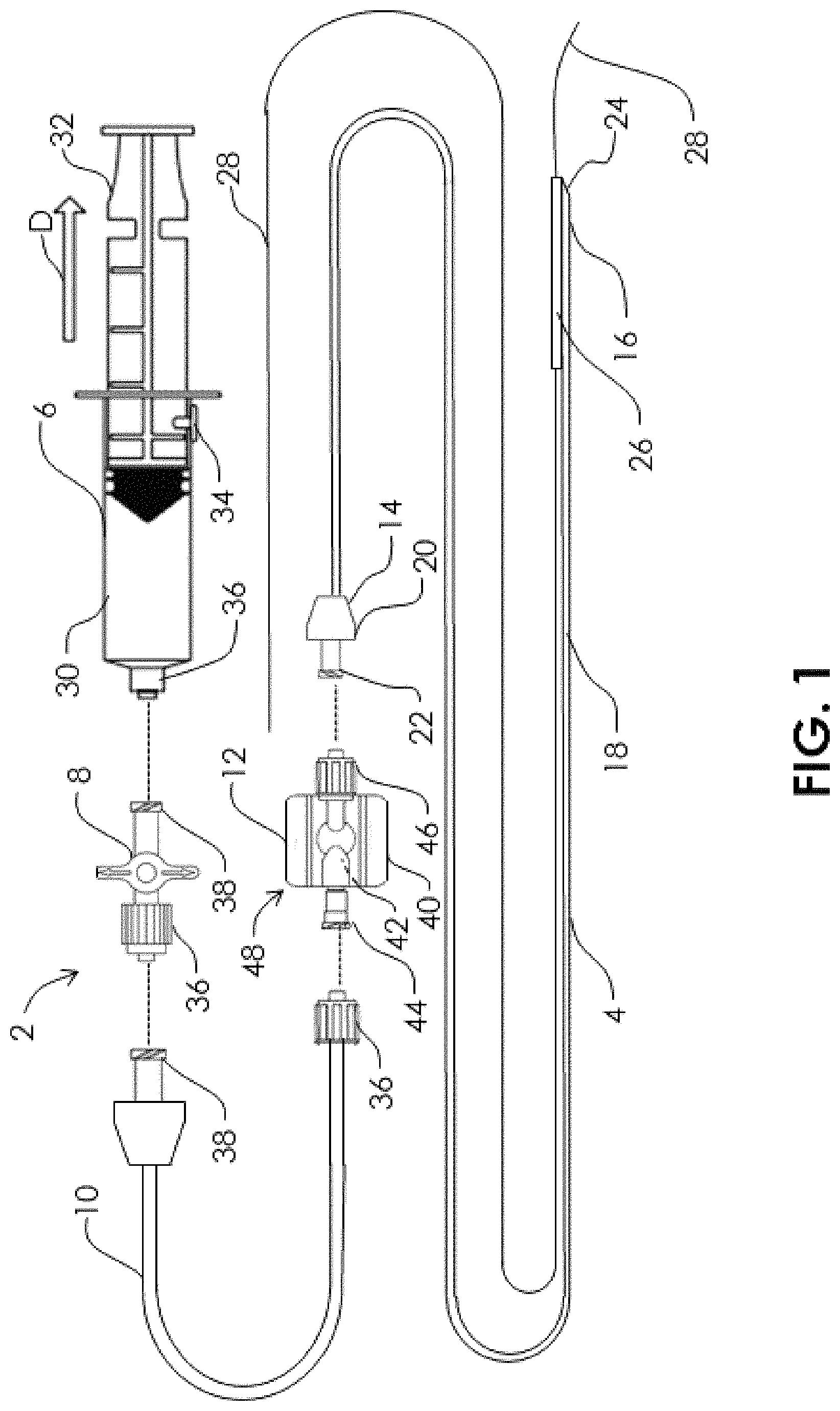 Patent US11771445 Figure 1 – Aspiration monitoring system and method