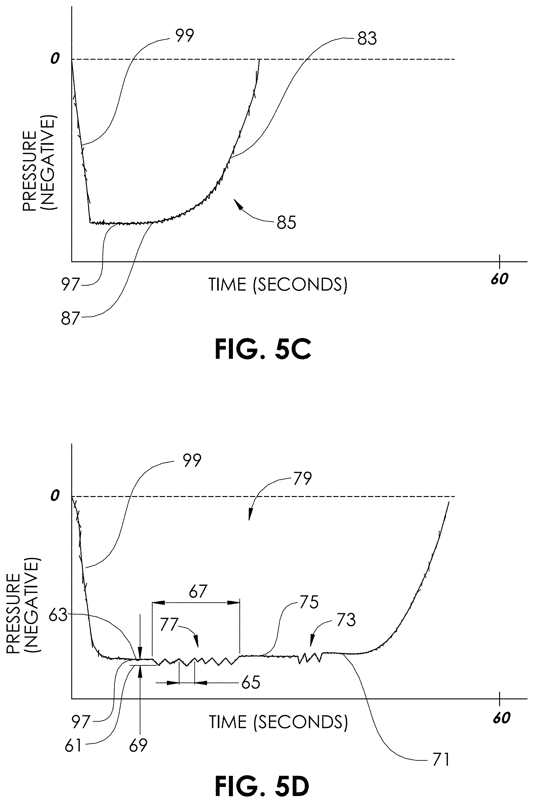 Patent US11771445 Figure 7 – Aspiration monitoring system and method