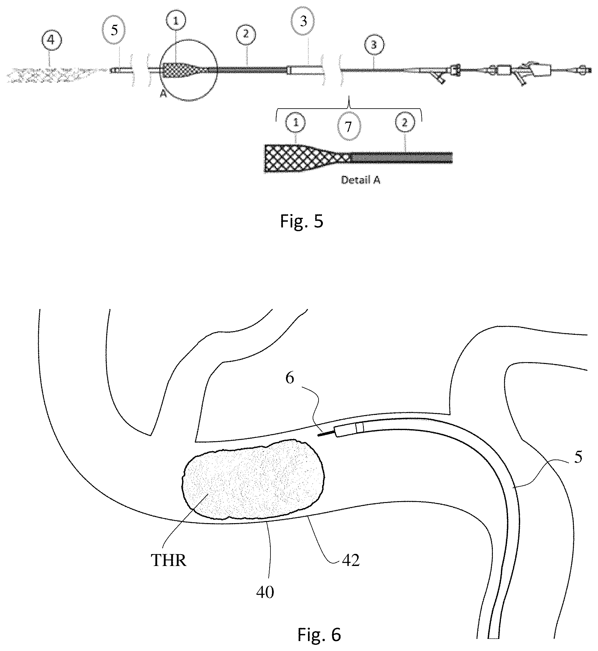 Patent US11771446 Figure 3 – Thrombectomy system and method of use