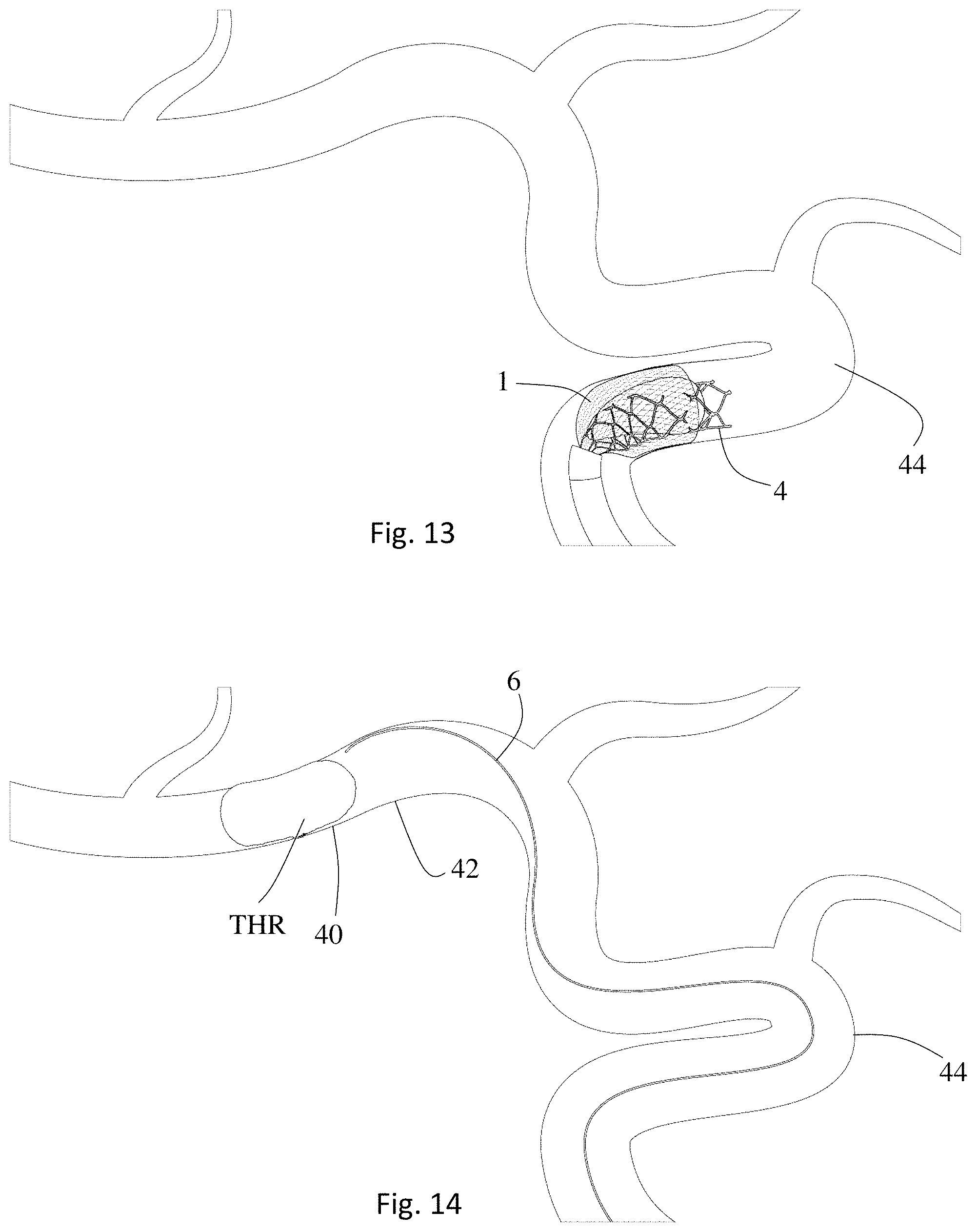 Patent US11771446 Figure 7 – Thrombectomy system and method of use