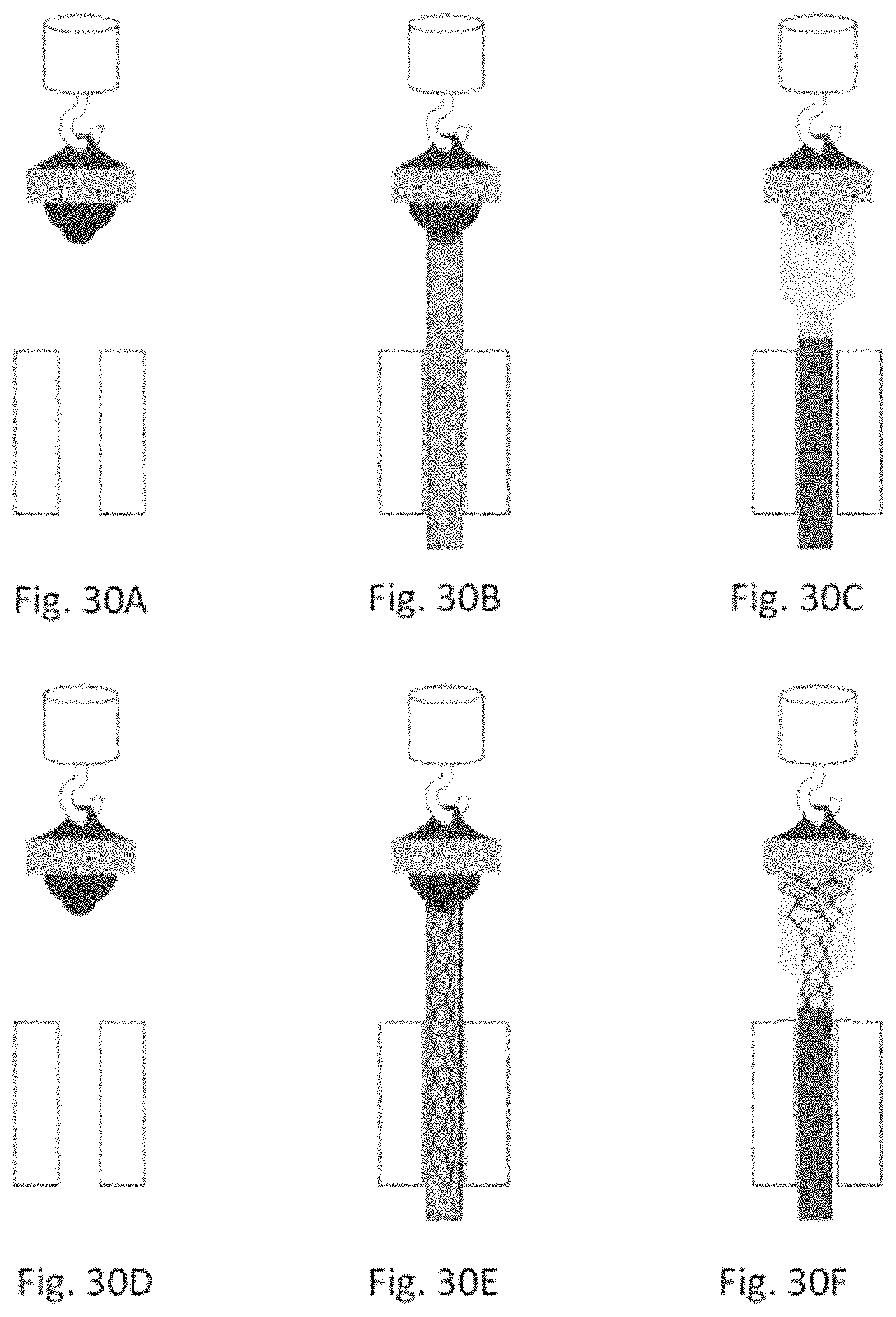 Patent US11771446 Figure 16 – Thrombectomy system and method of use