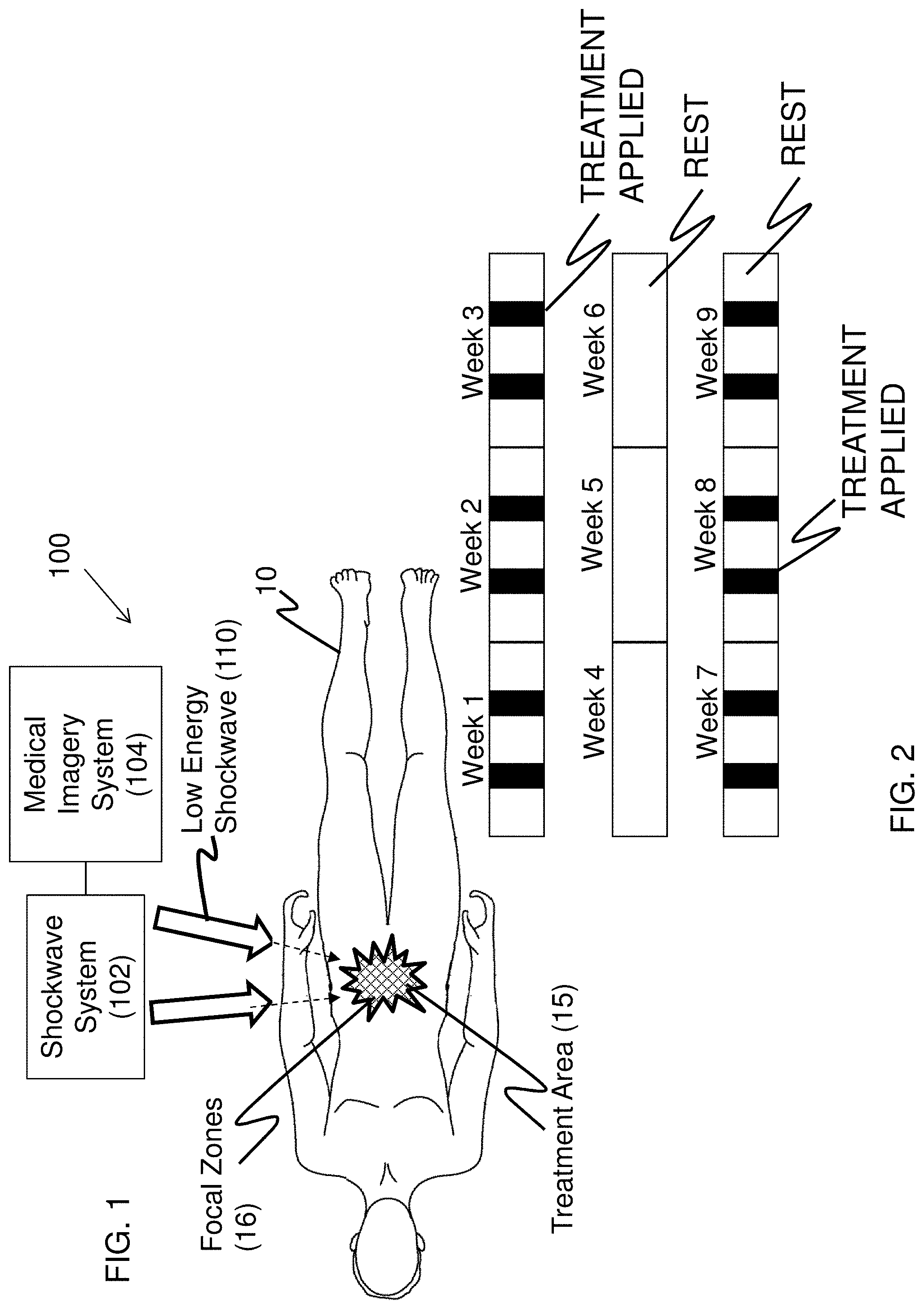 Patent US11771447 Figure 1 – Method of treatment with low energy extracorporeal shockwaves